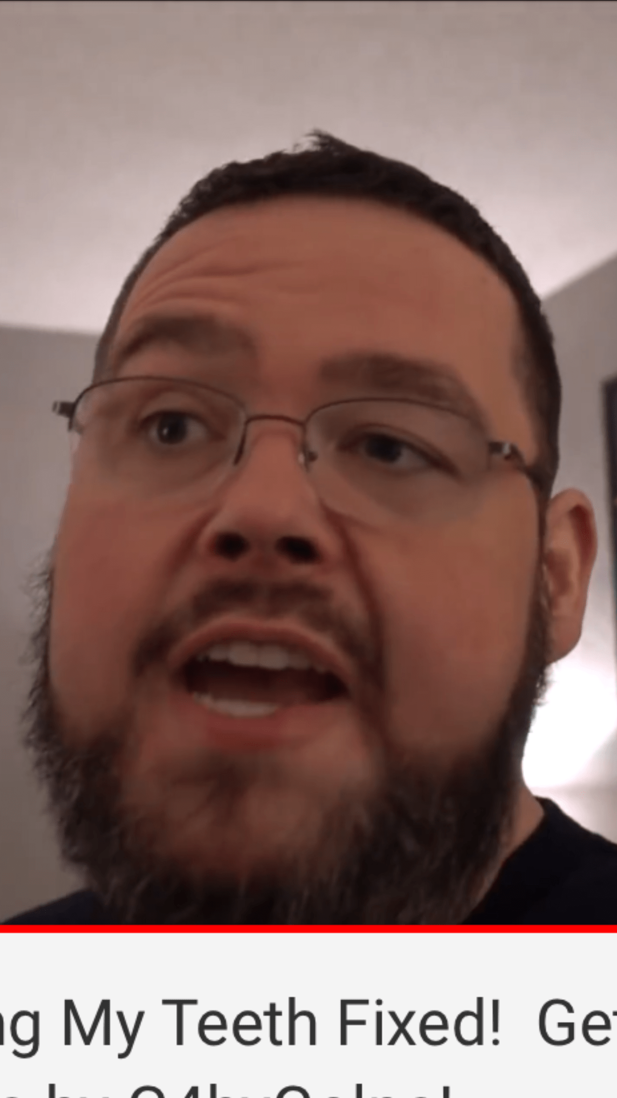 Teeth Hurt After Cleaning Reddit TeethWalls