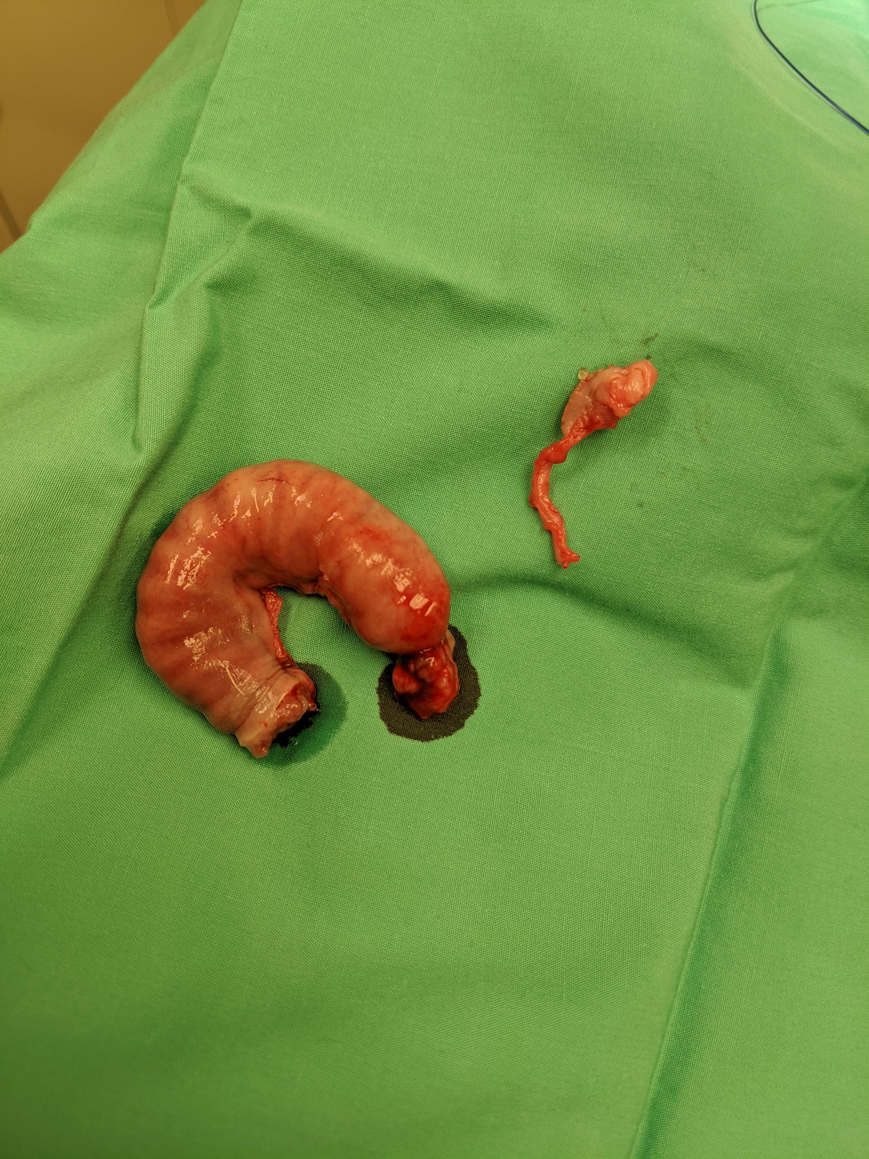 Spayed a cat today that had both uterine unicornis and hydrometra VetTech