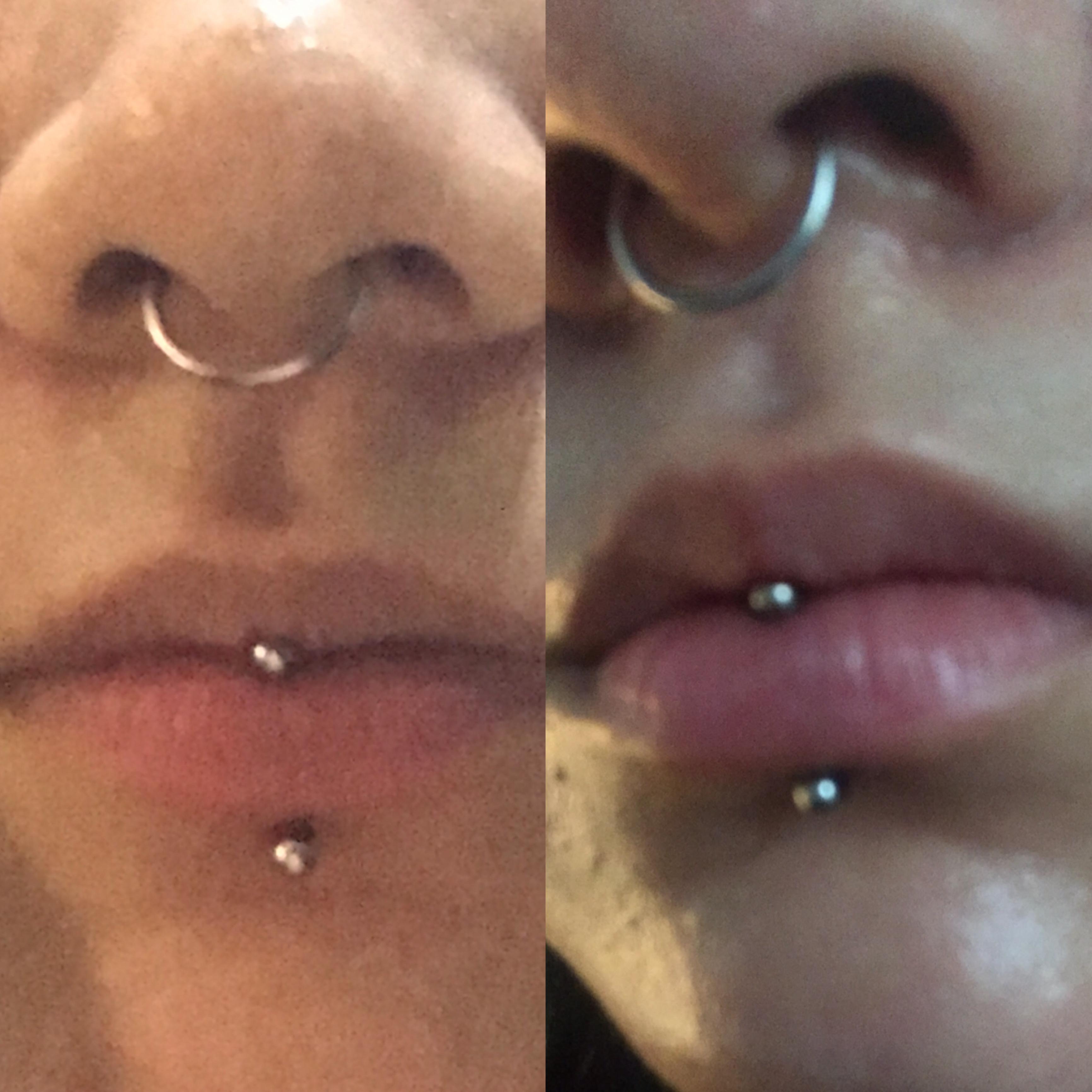 Vertical Labret Piercing Pain