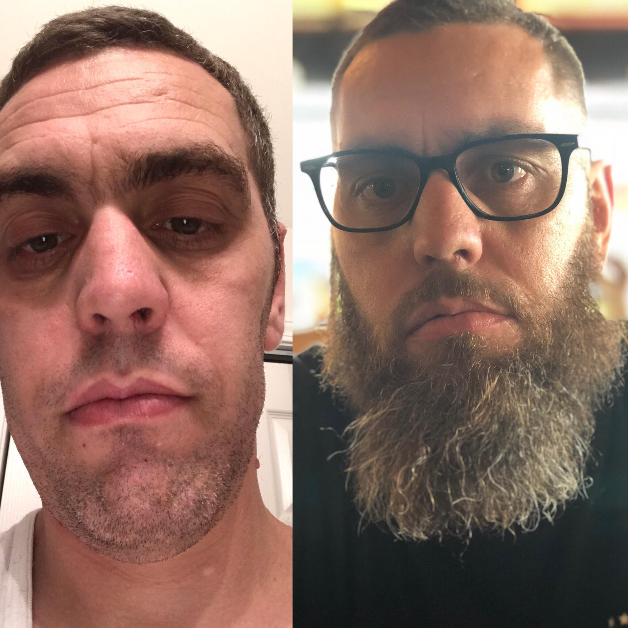 Since everyone else doing it here’s my “ push up bra” pics r/beards