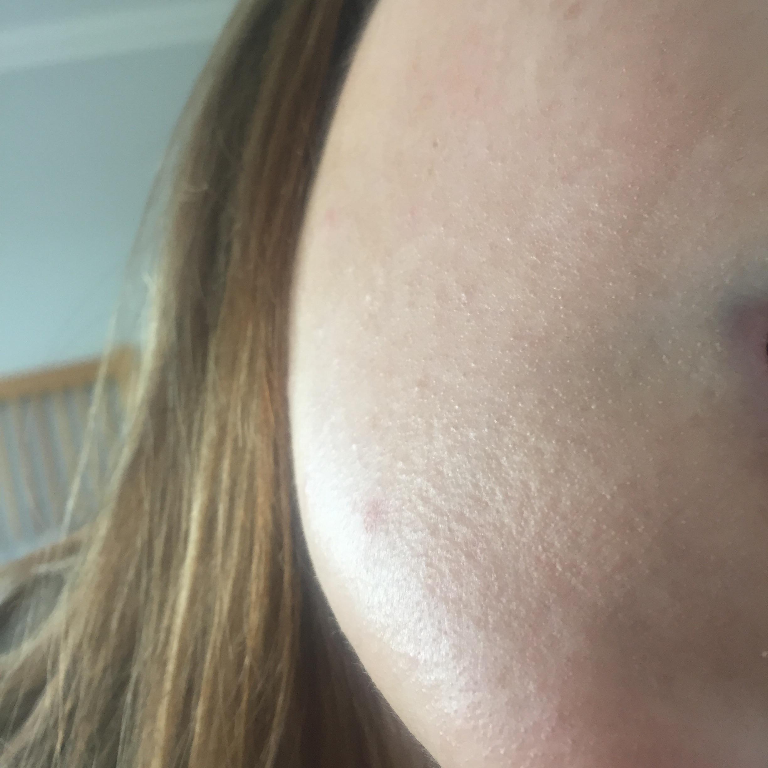 [skin concerns] I dehydrated my skin using Paula’s choice bha and aha