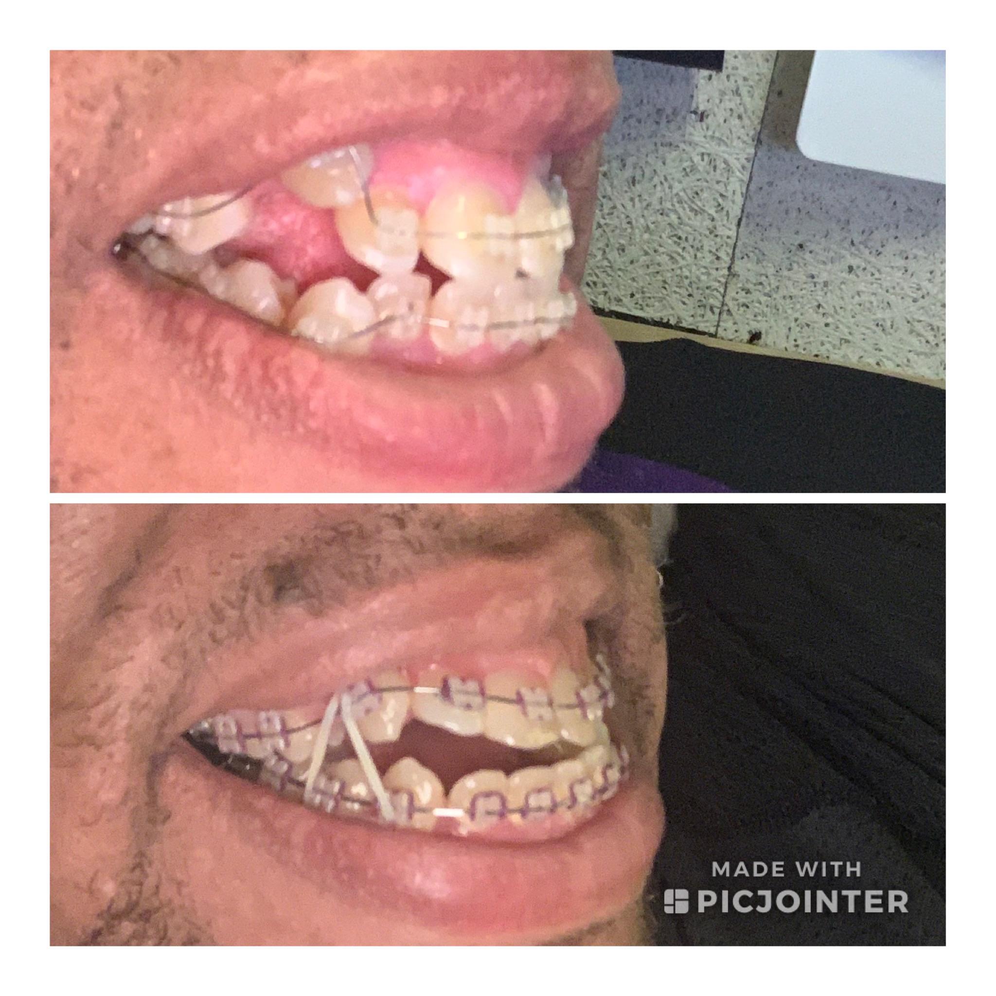 4 appointments in the books since January and making great progress on