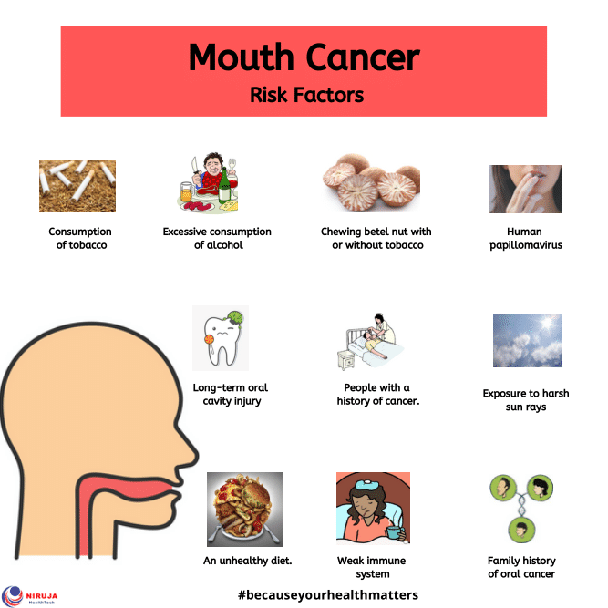 Mouth Cancer Risk Factors r/Infographics