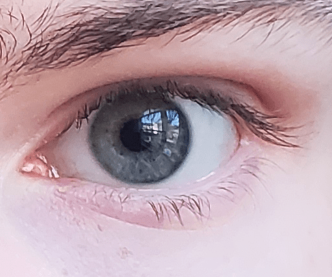 CharcoalGrey Eyes r/eyes