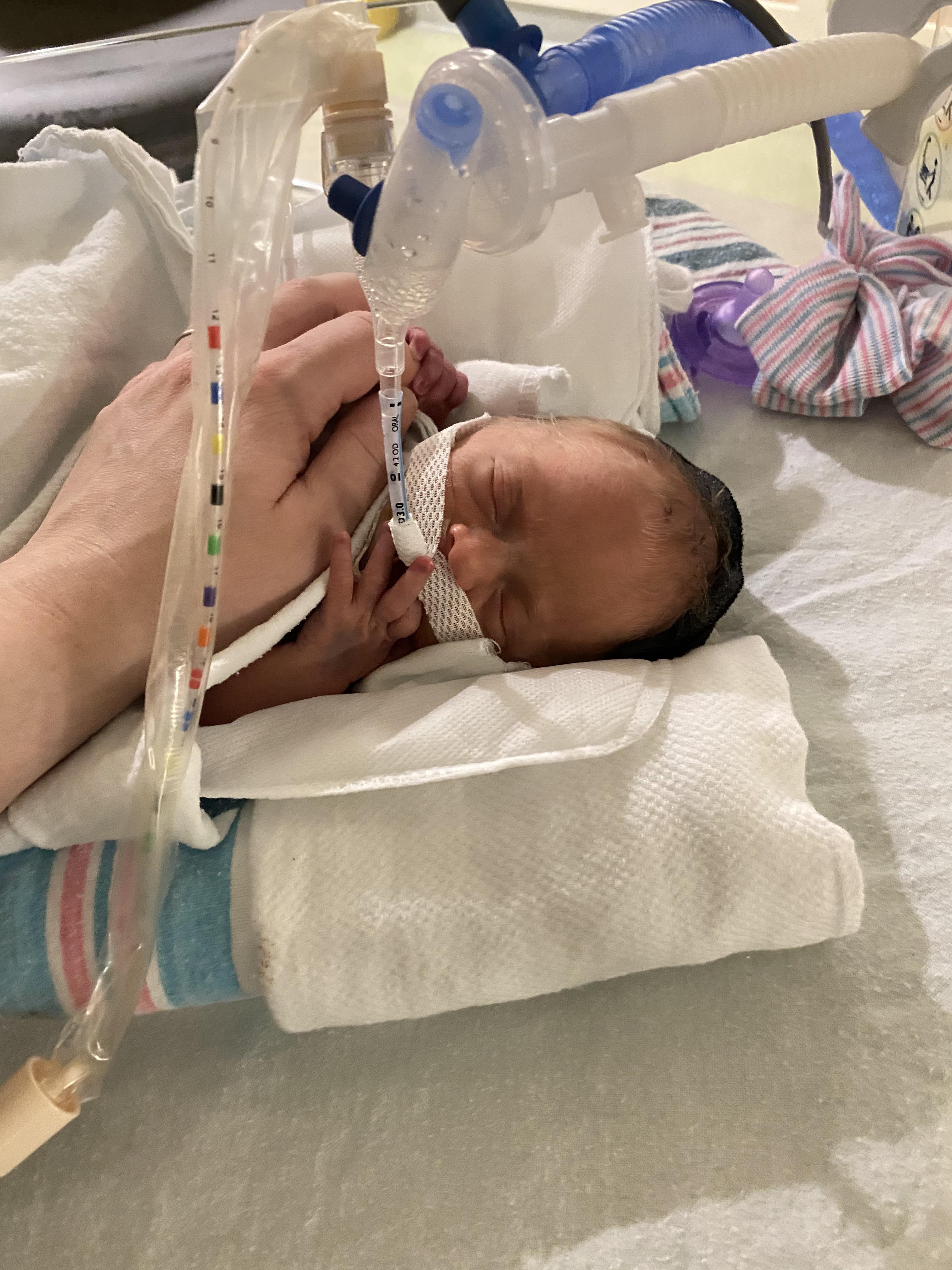 My little one. After an emergency c section, my little one was born at