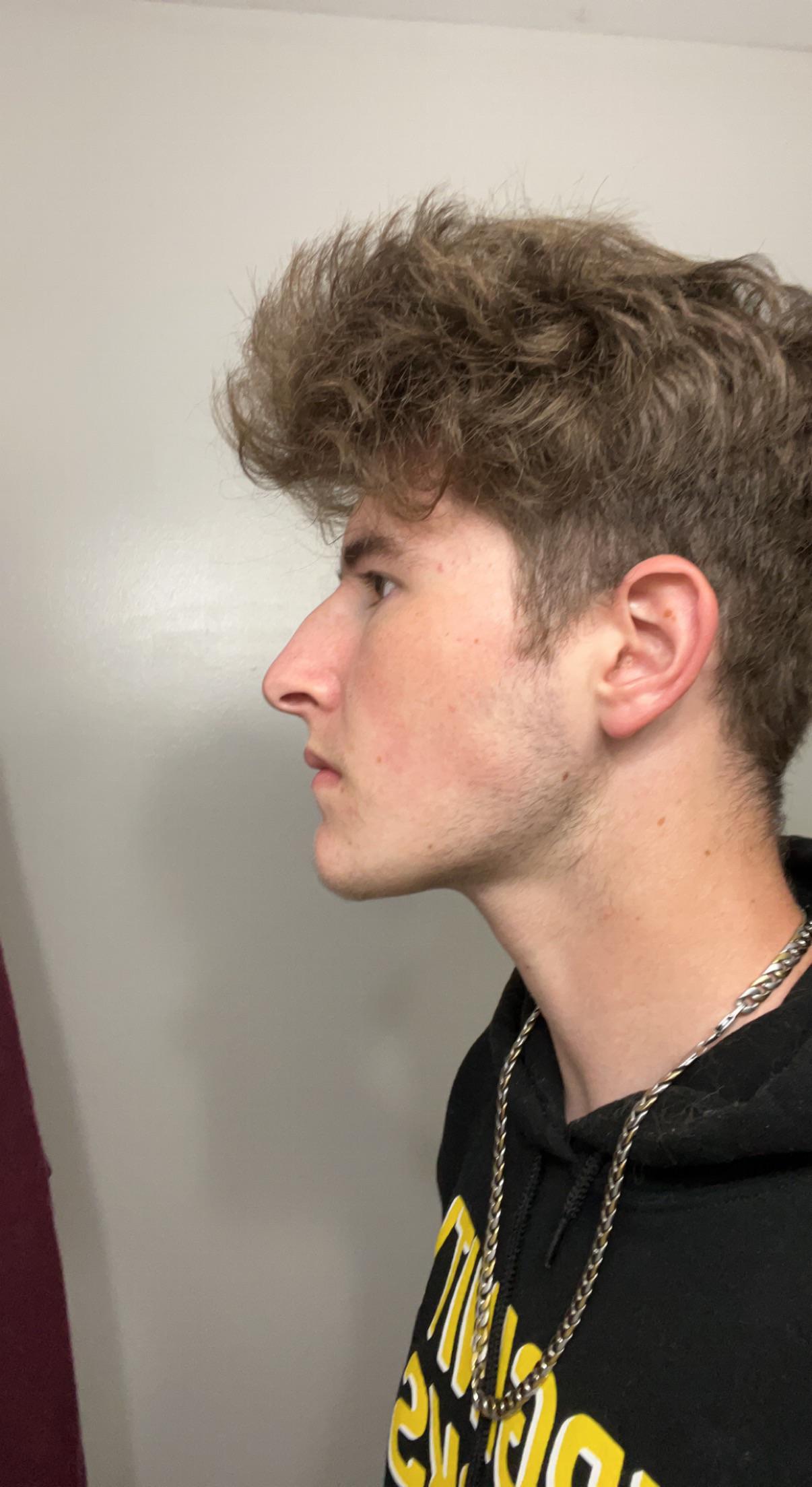 This is my first ever reddit post and recently i’ve been told i have a