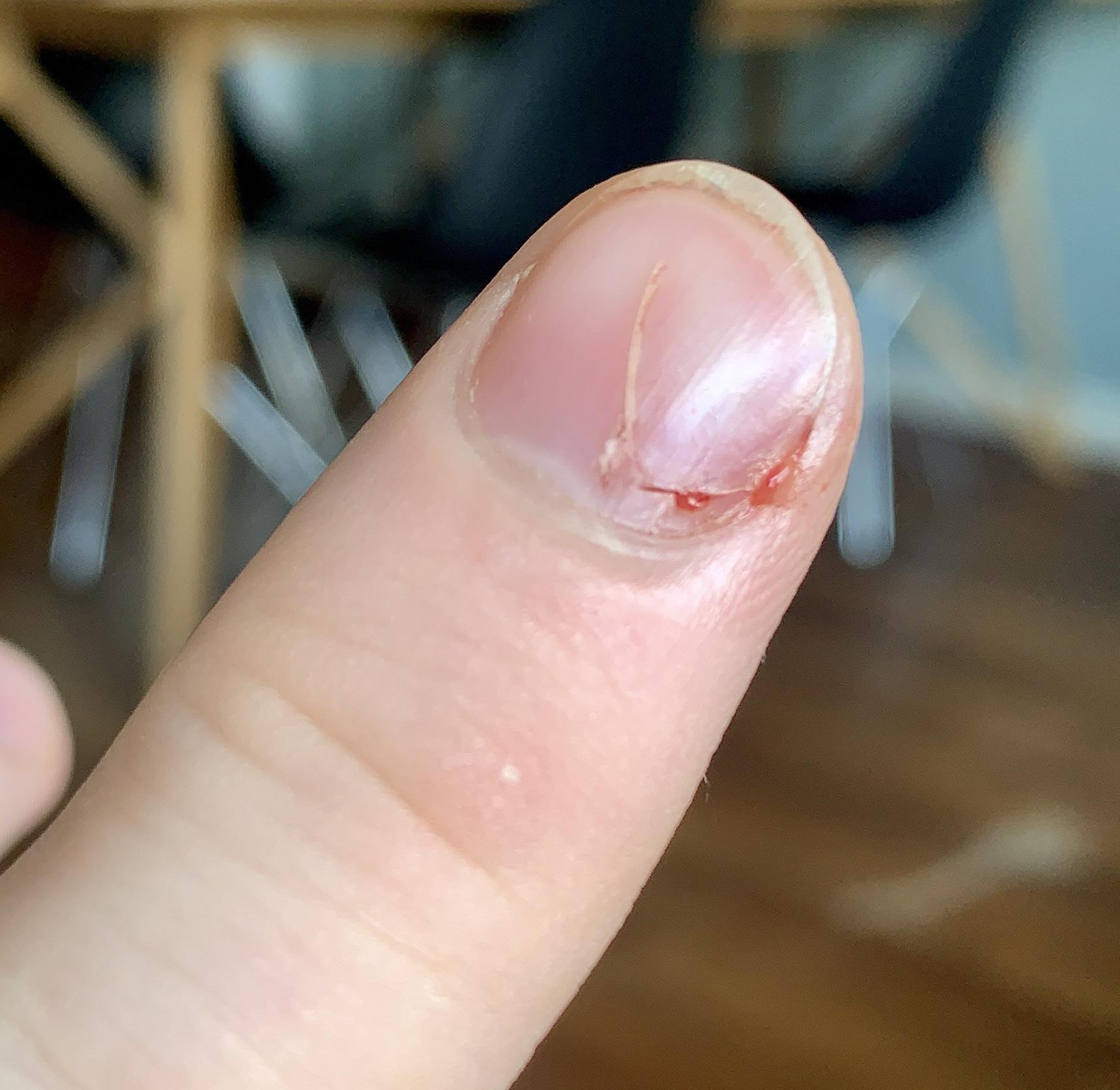 Sharpened my knife, cut trough my fingernail... r/awfuleverything