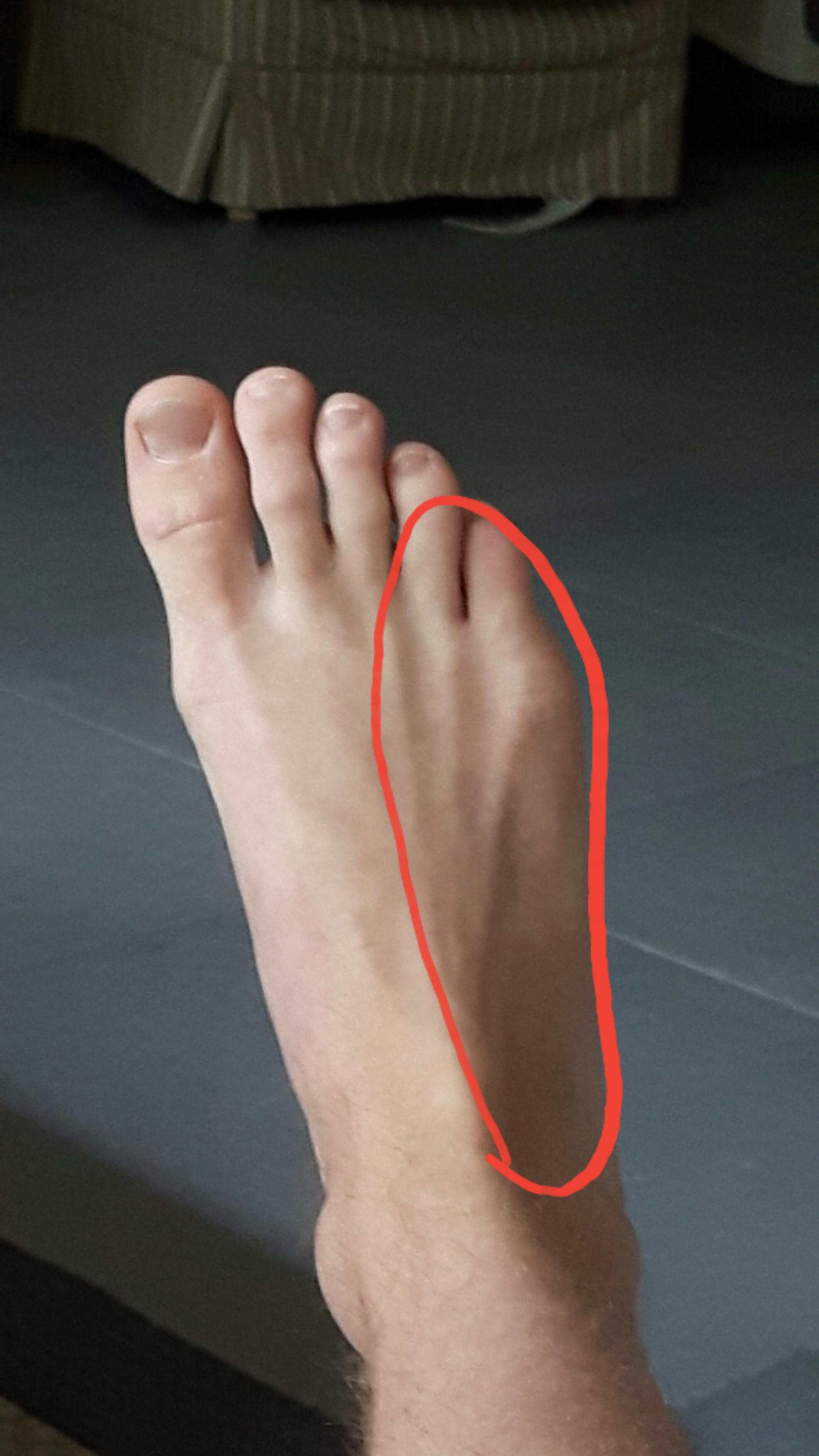 This part of my foot hurts after kicking in TKD. What am I doing wrong