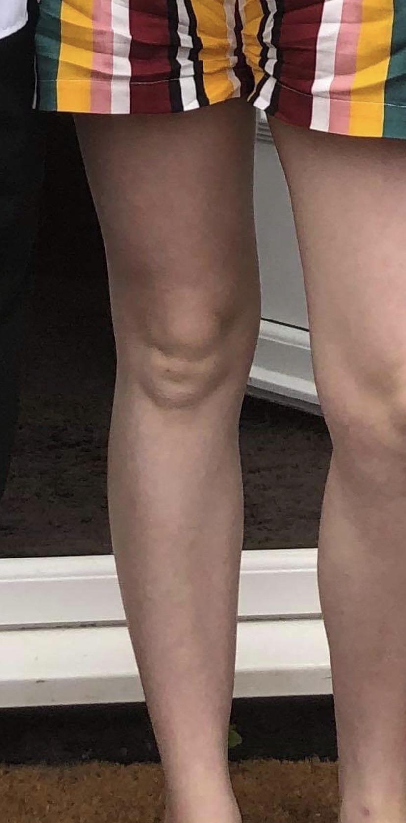 Babyface Knees at Tracey Parmelee blog