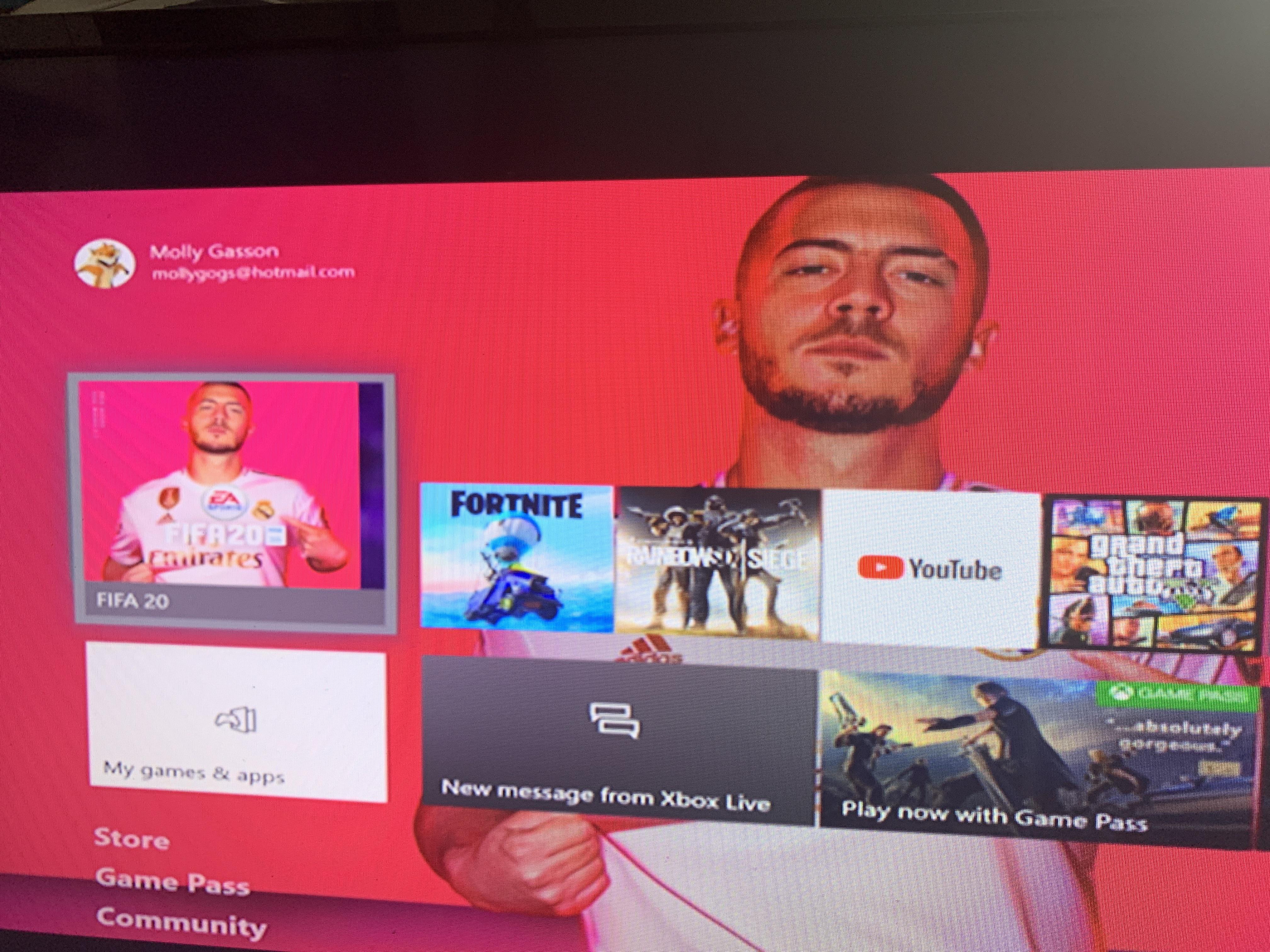 What do I do if my Xbox glitches like this to terrible quality and is