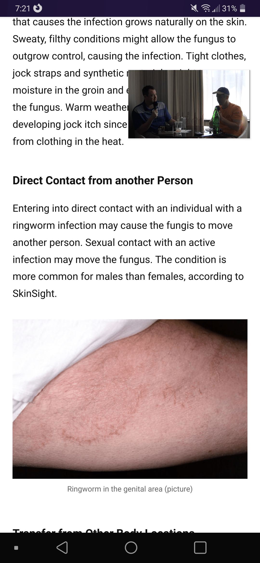 Shane's girl transferred the ringworm? People are saying... r