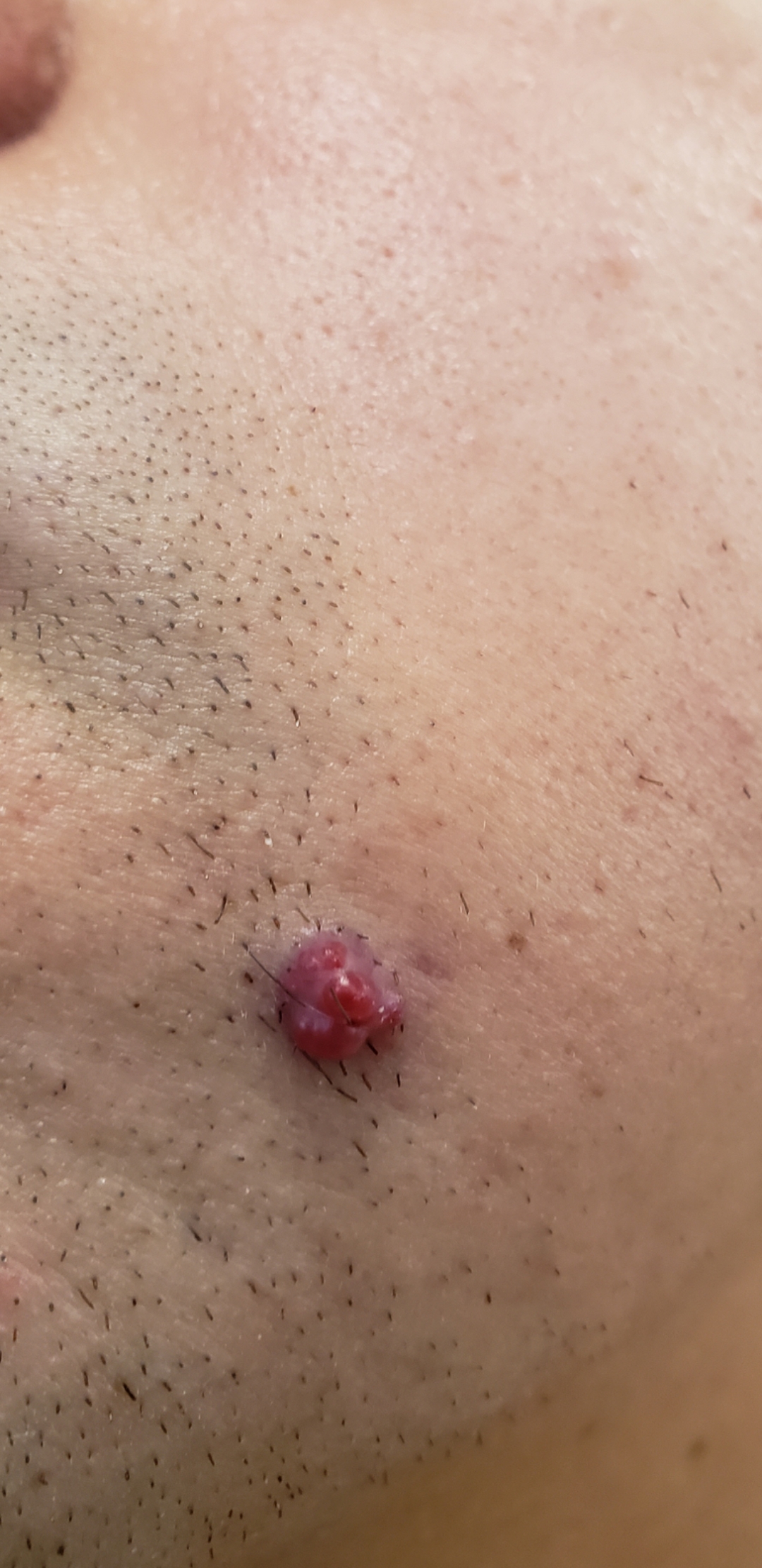 I have had these spots all over my arms and legs for several years. It
