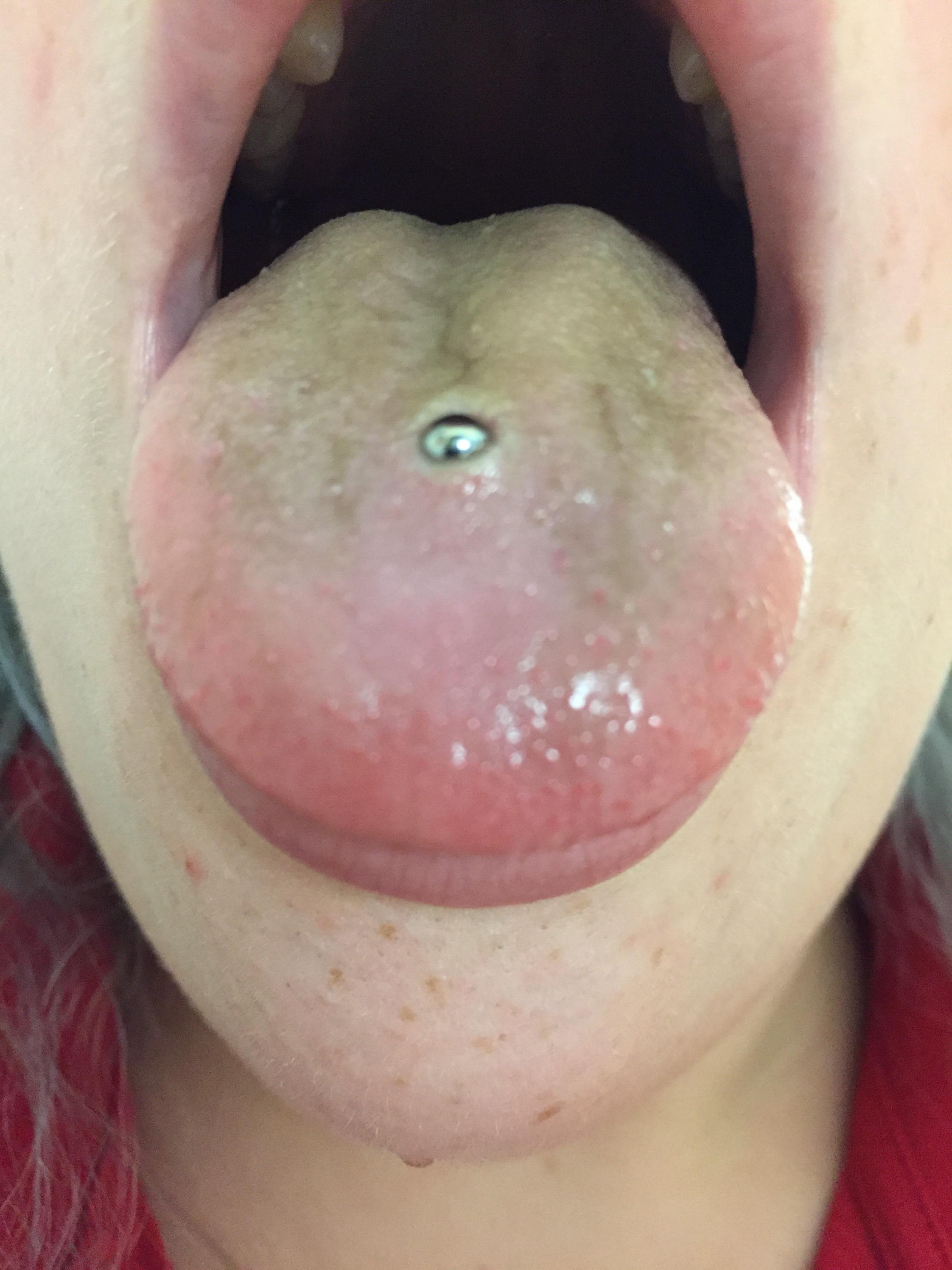 4 DayOld Tongue Piercing. Nesting too much? More in comments piercing