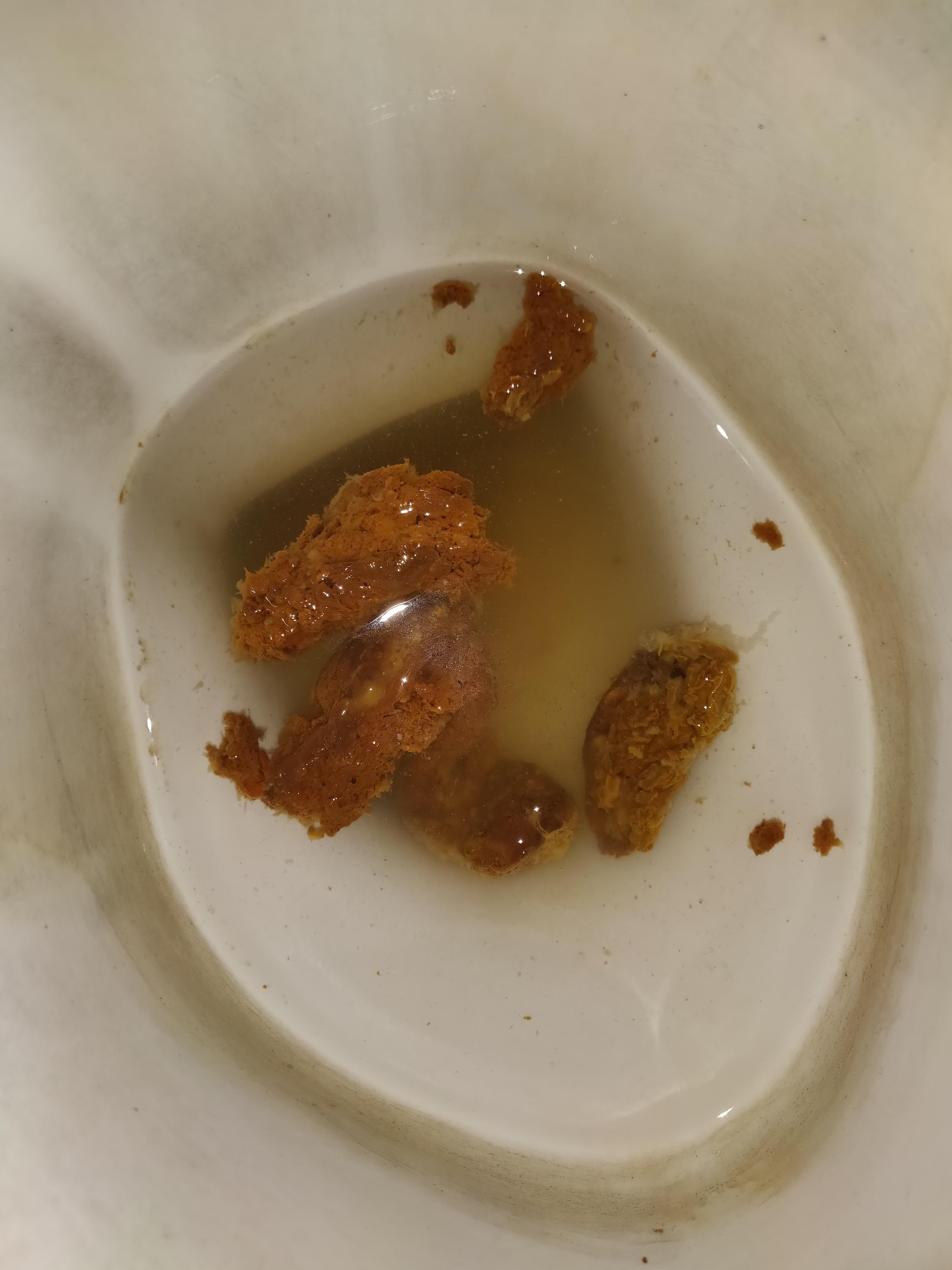 [38+] Worms In Human Poop Pictures