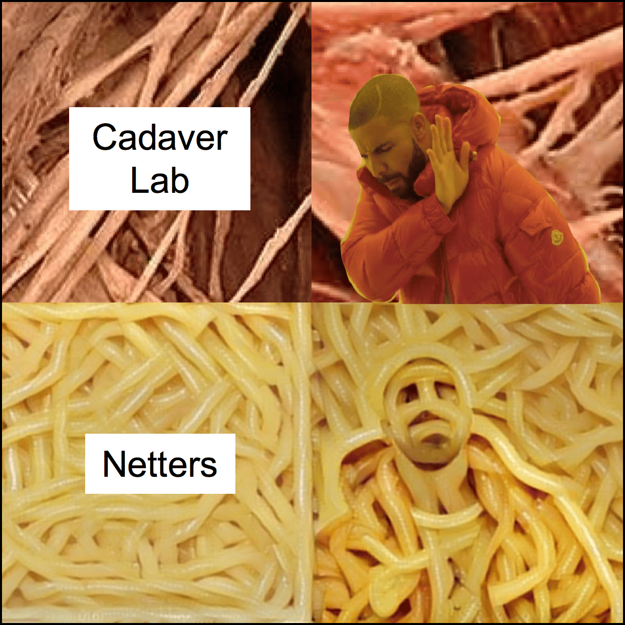 [Meme] It all looks like spaghetti medicalschool