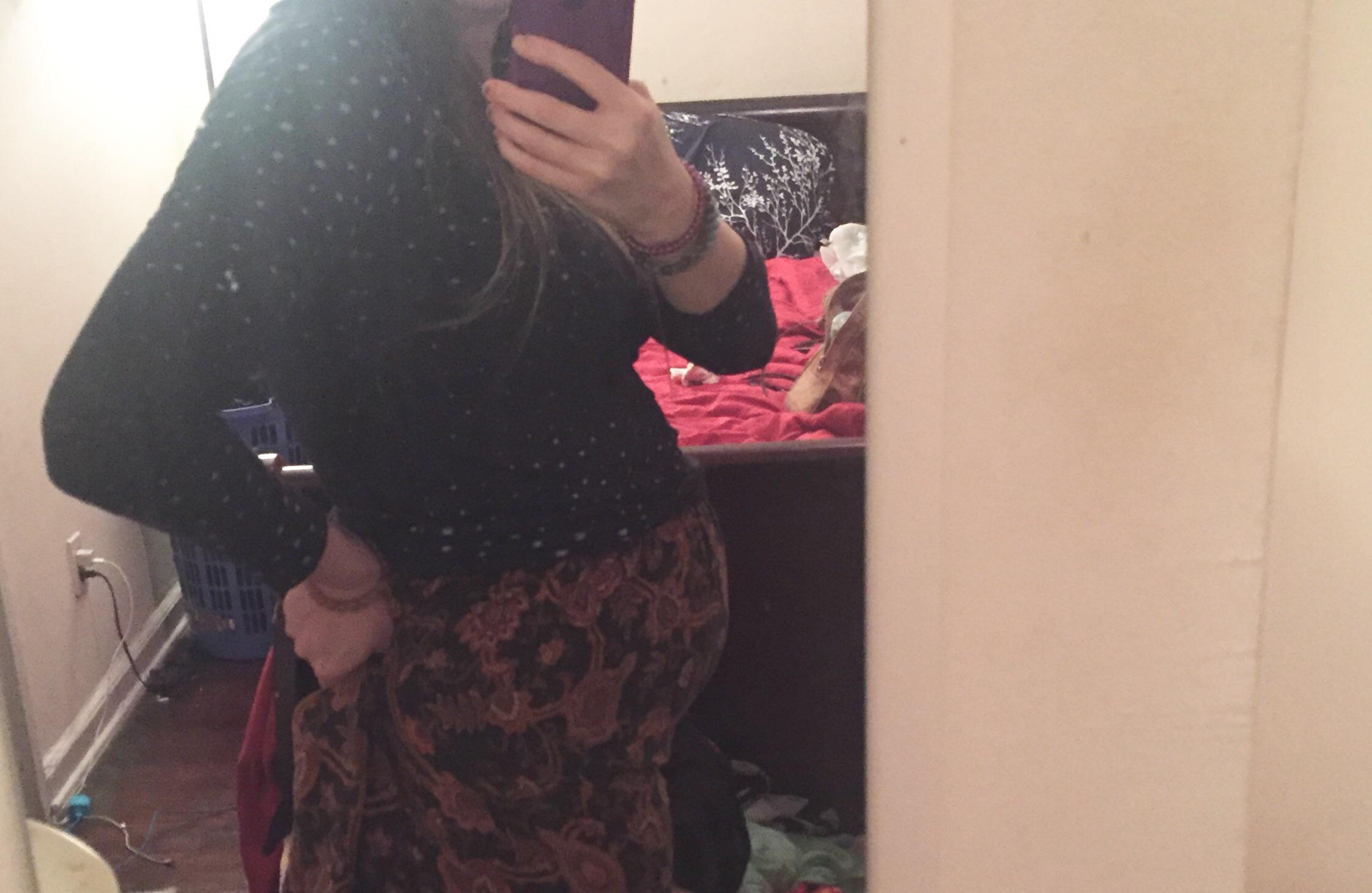 Check out my sweet endo belly. 😩 I feel like an orb r/endometriosis