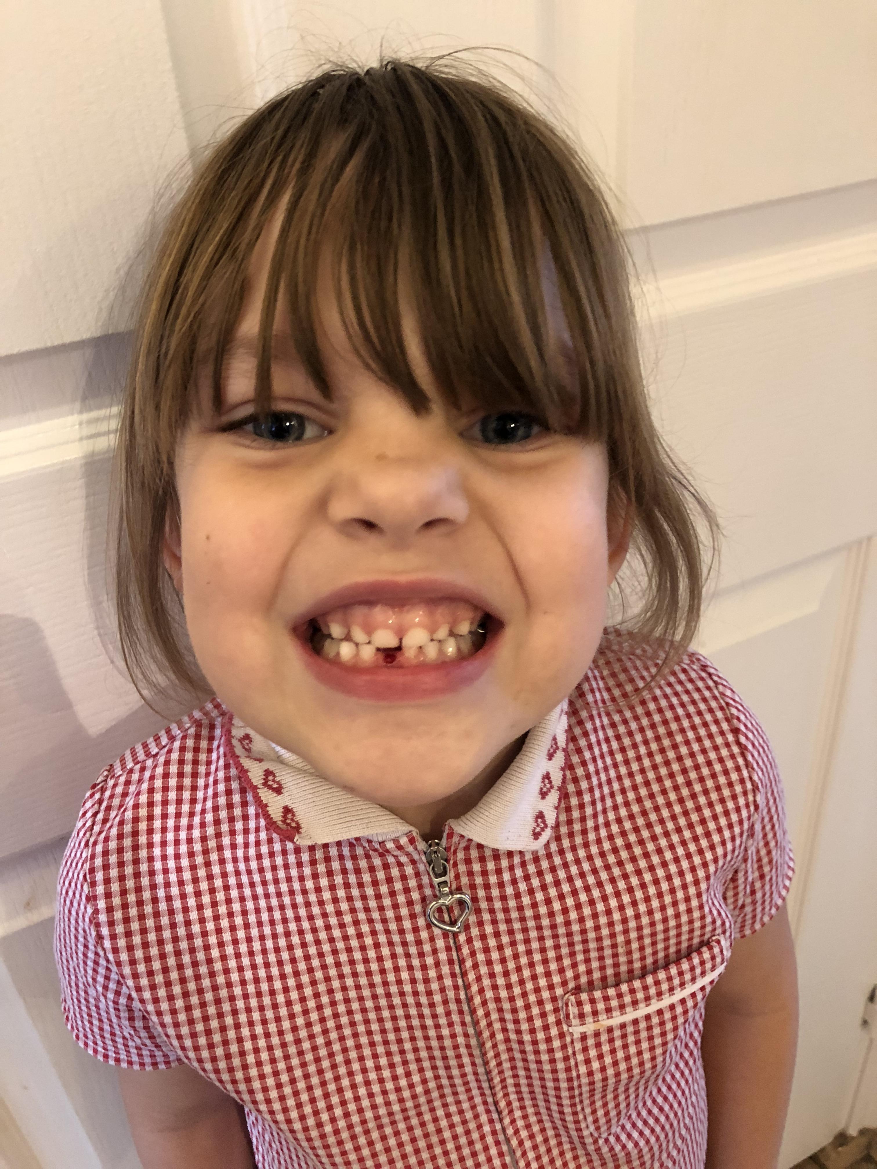 What’s the going rate for the tooth fairy these days? r/daddit