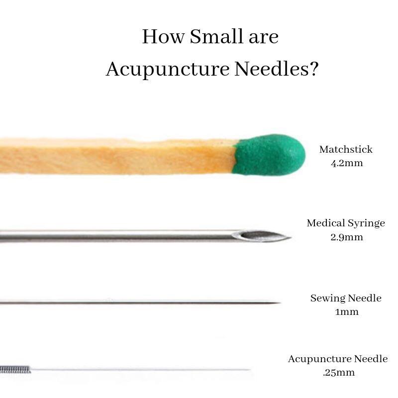 FAQ Bodies of Wisdom Acupuncture