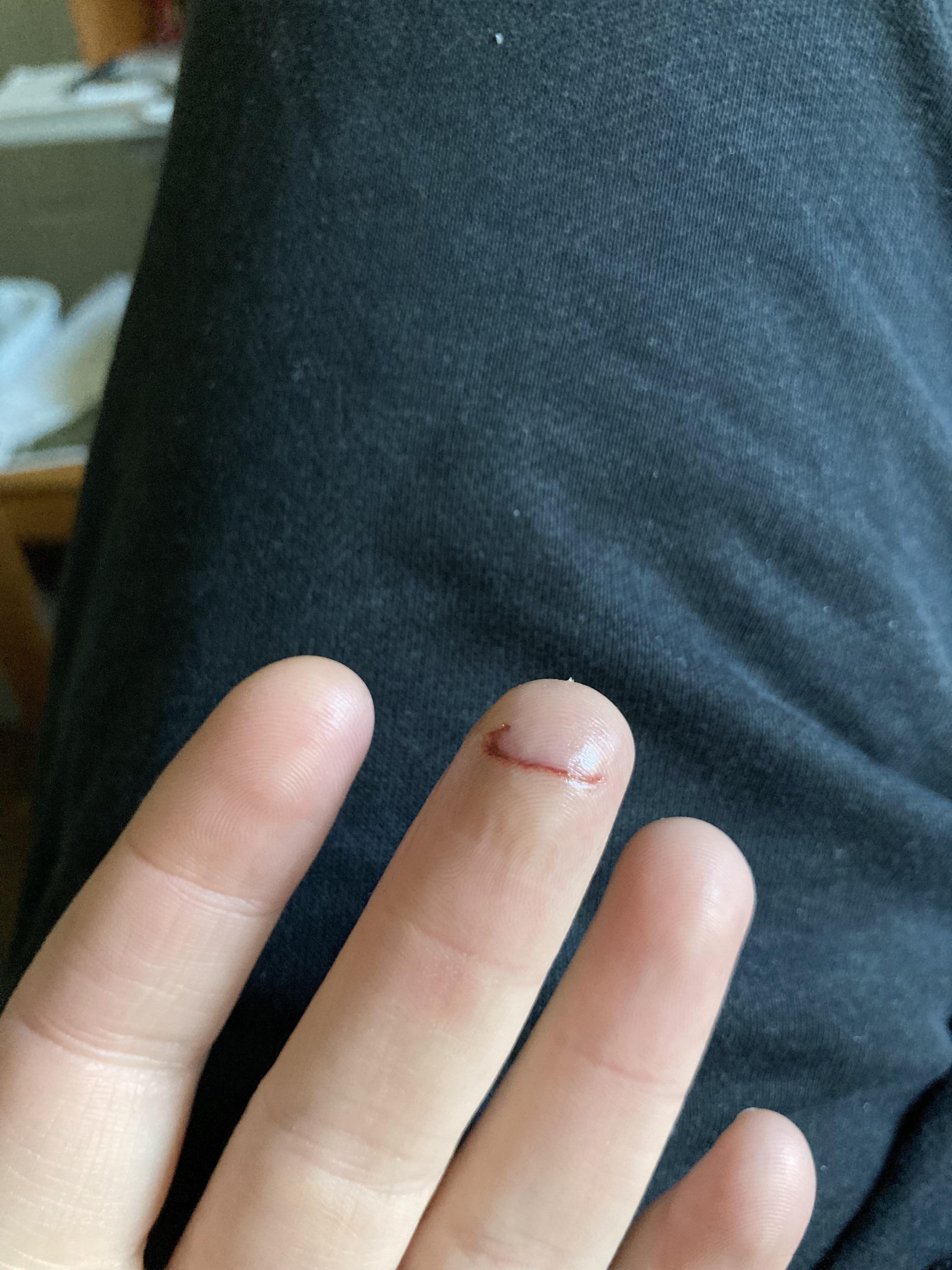 Cut on my finger healing like a Nike sign r/mildlyinteresting