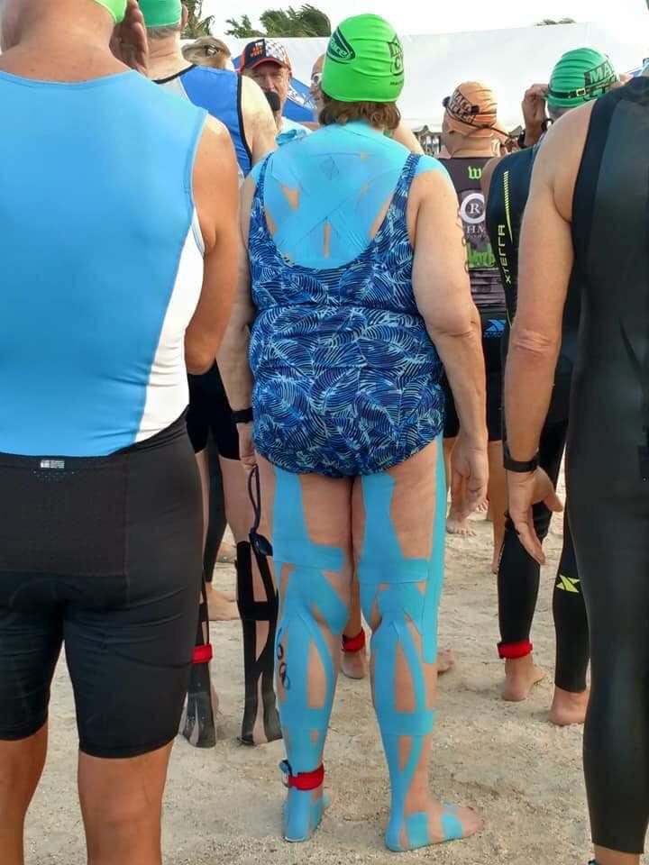 Is KT Tape Legit? MotoRelated Motocross Forums / Message Boards Vital MX