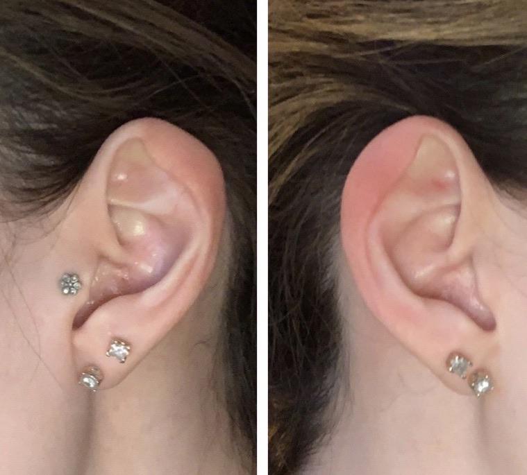 I’ve always wondered if there was a name for this weird fold at the top