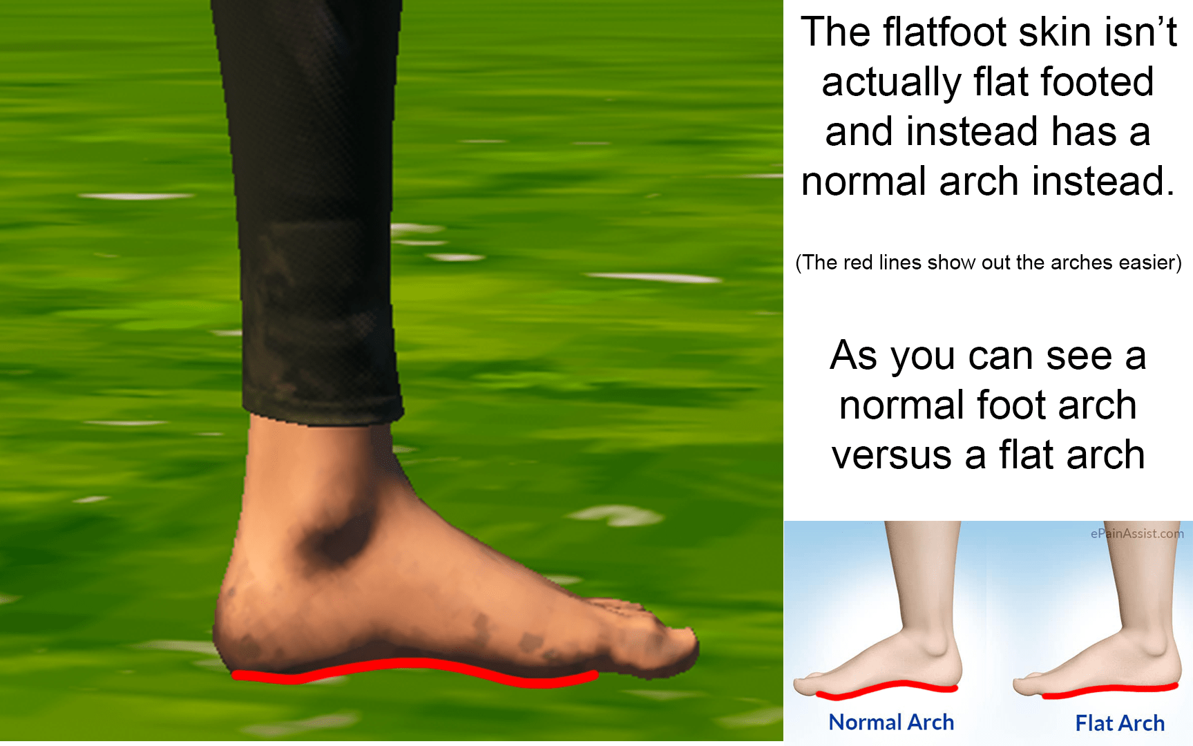 [2021] The flatfoot skin doesn't actually have flat feet! Literally