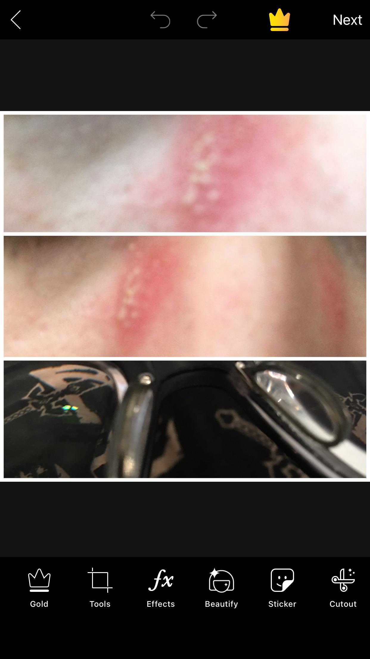 I could really use some help I think I’m allergic to my glasses