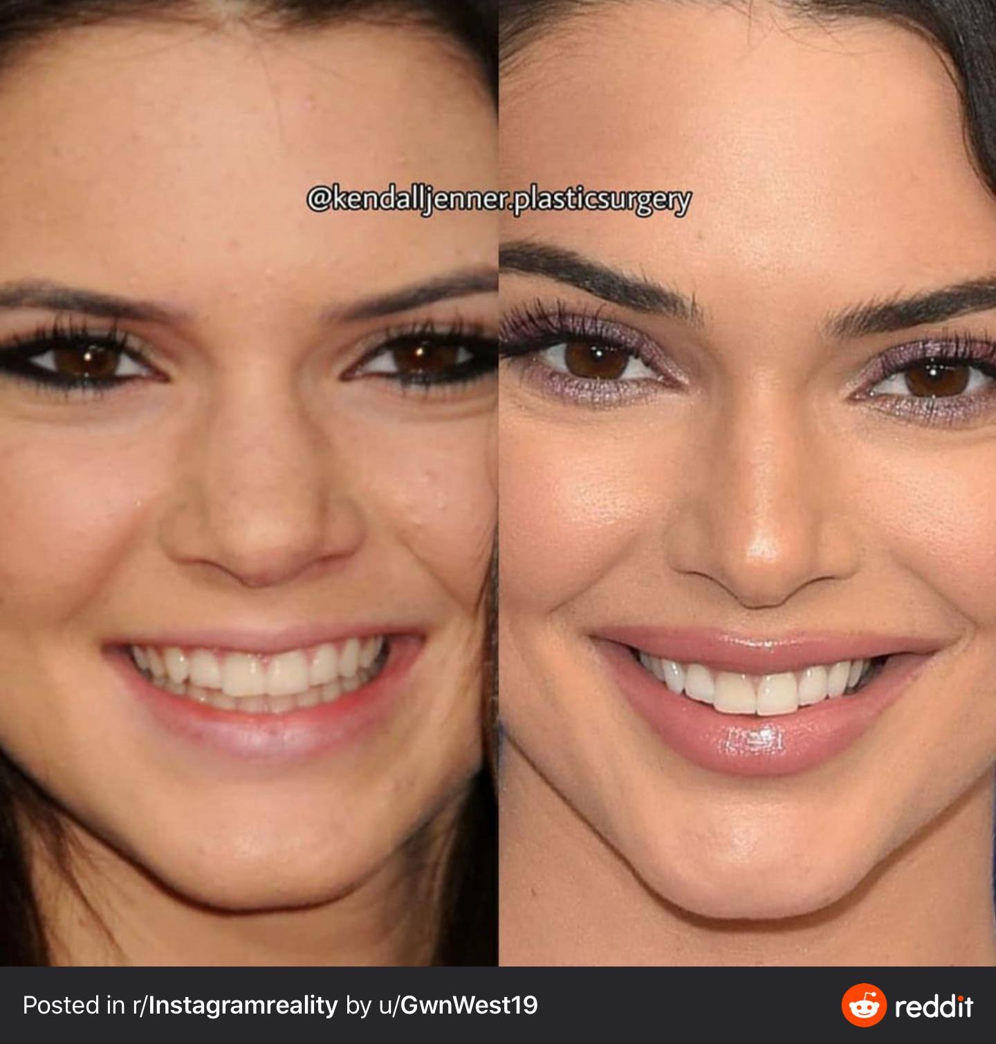 How did she manage to get a narrower palate? And why? I thought most