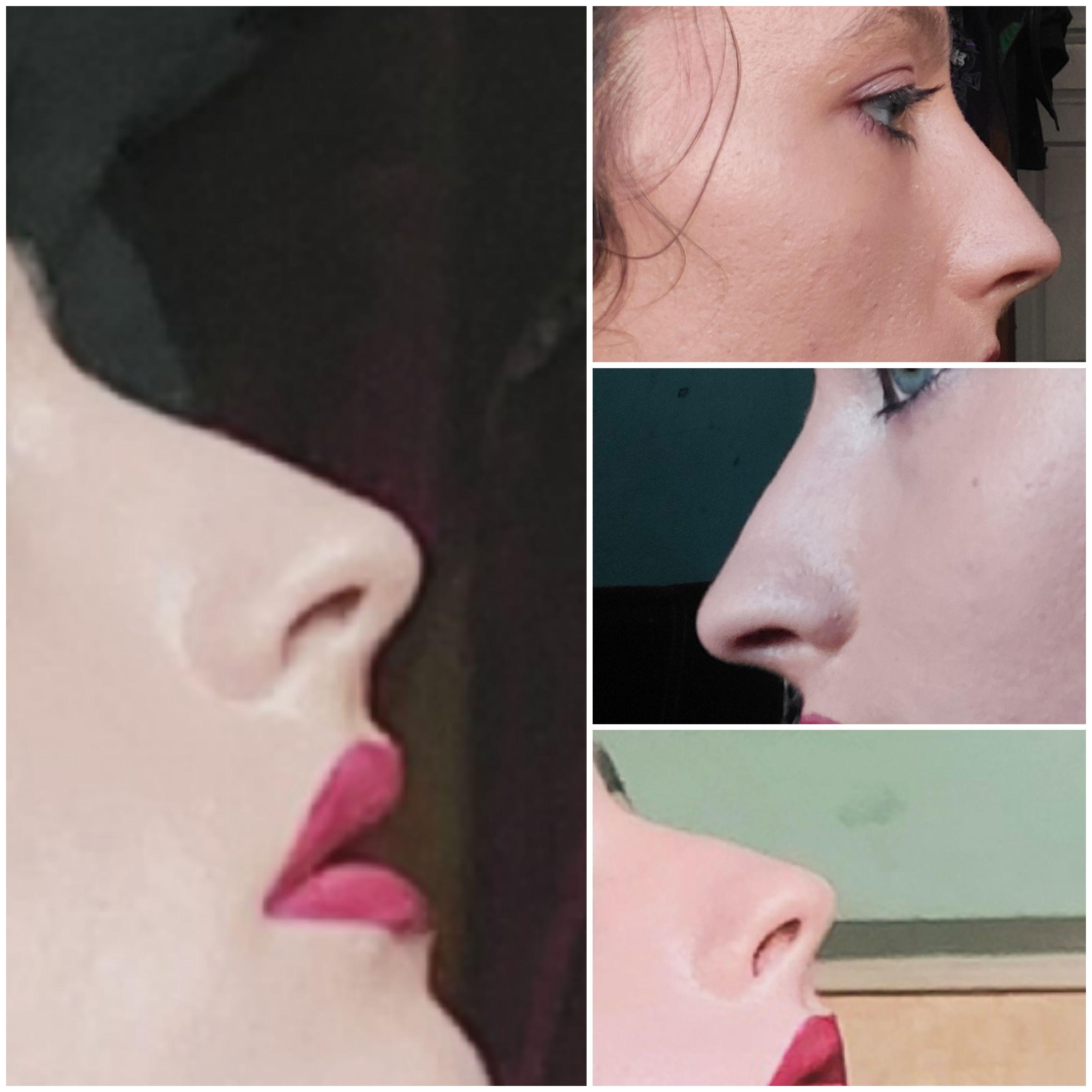 Concave and Convex Noses