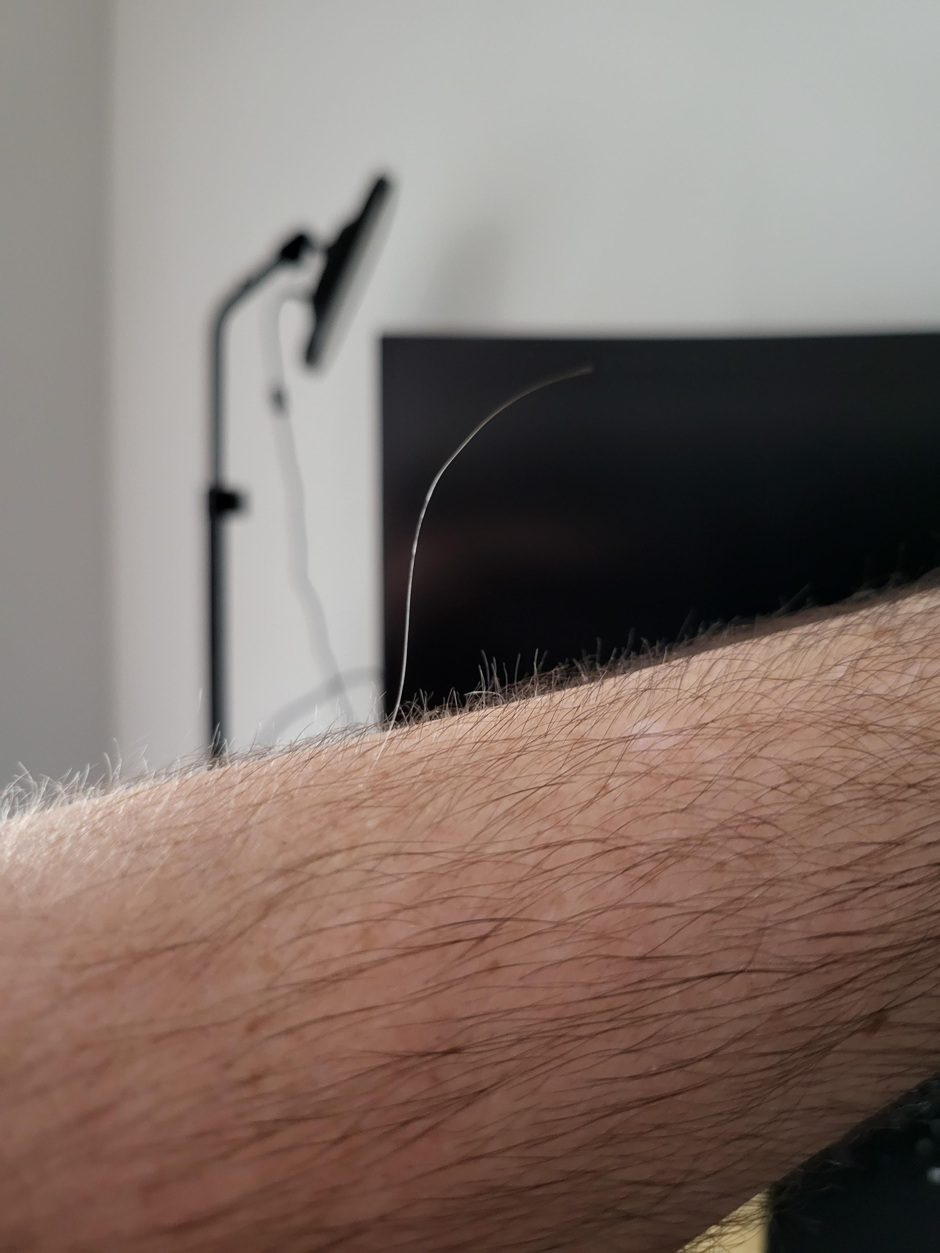 My abnormally long arm hair r/mildlyinteresting