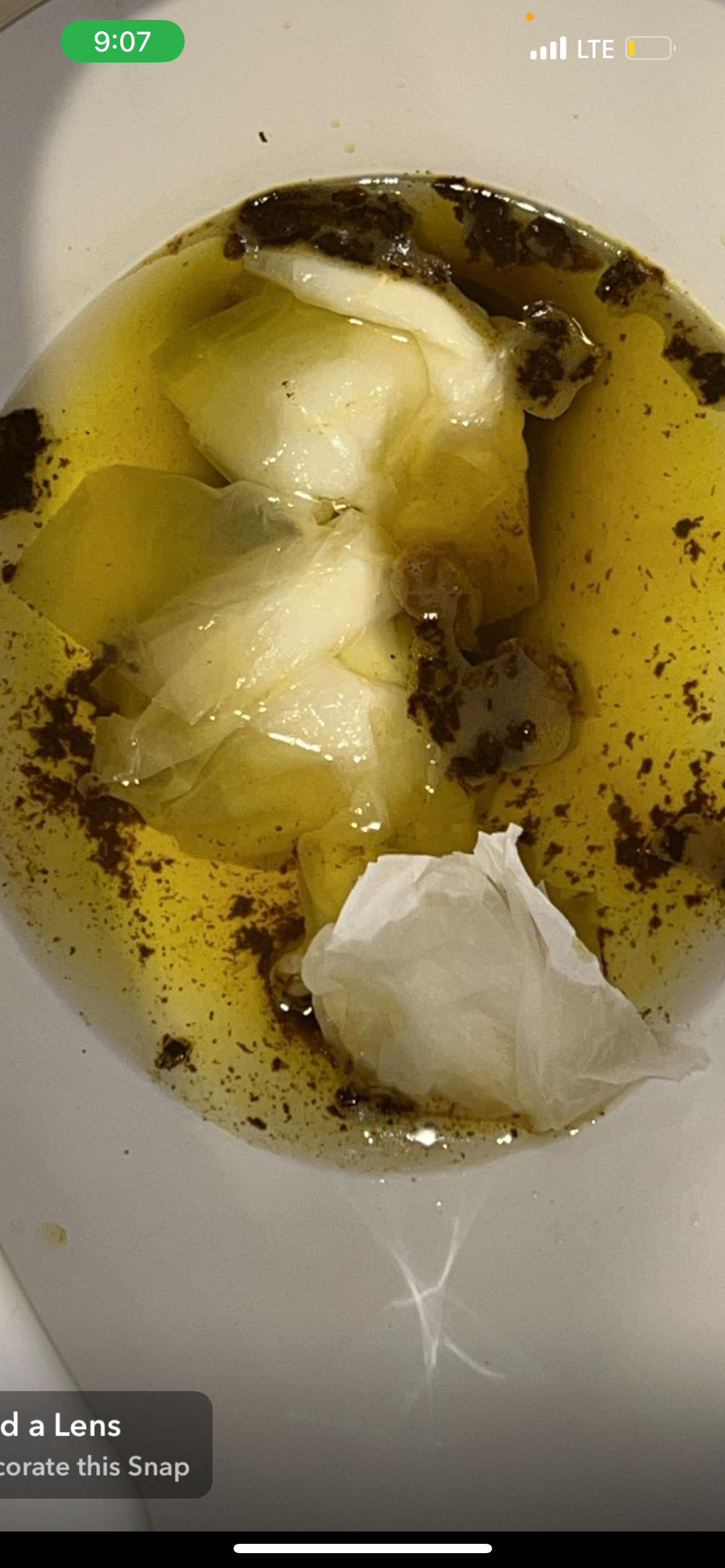 Coffee ground stool?? Concerning?? r/medical_advice