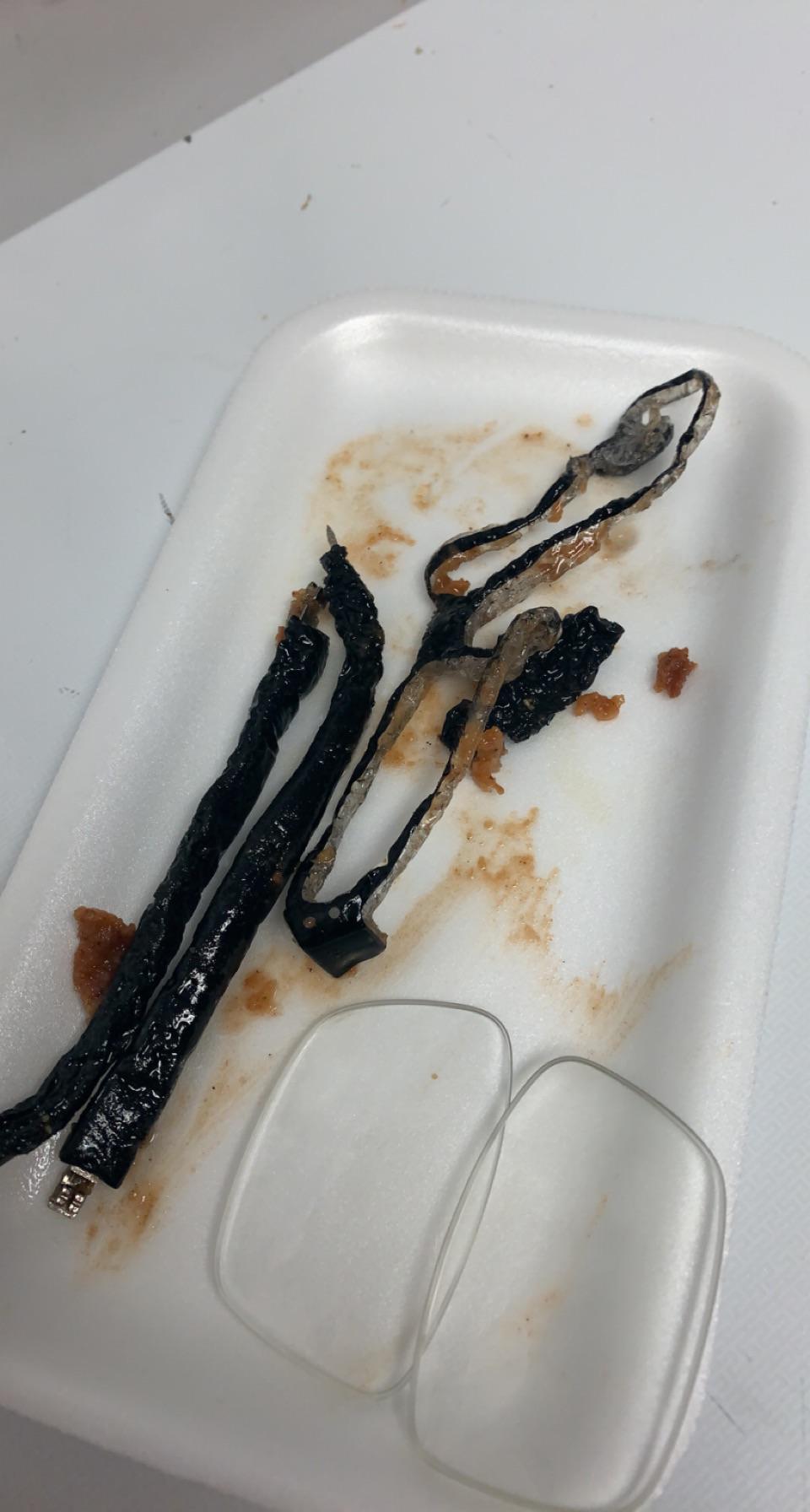 When you work in the kitchen and your glasses fall in the fryer.🙃 r/fastfoodworkers