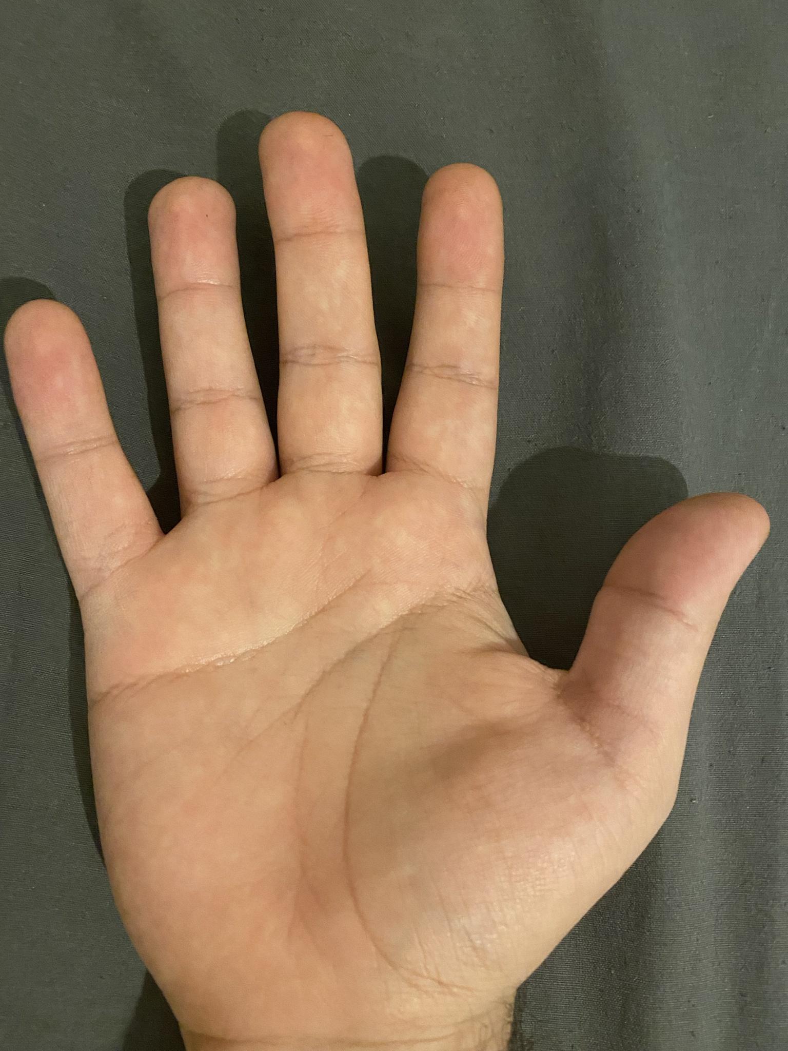 My right pinky finger has only one crease r/MundanelyFascinating