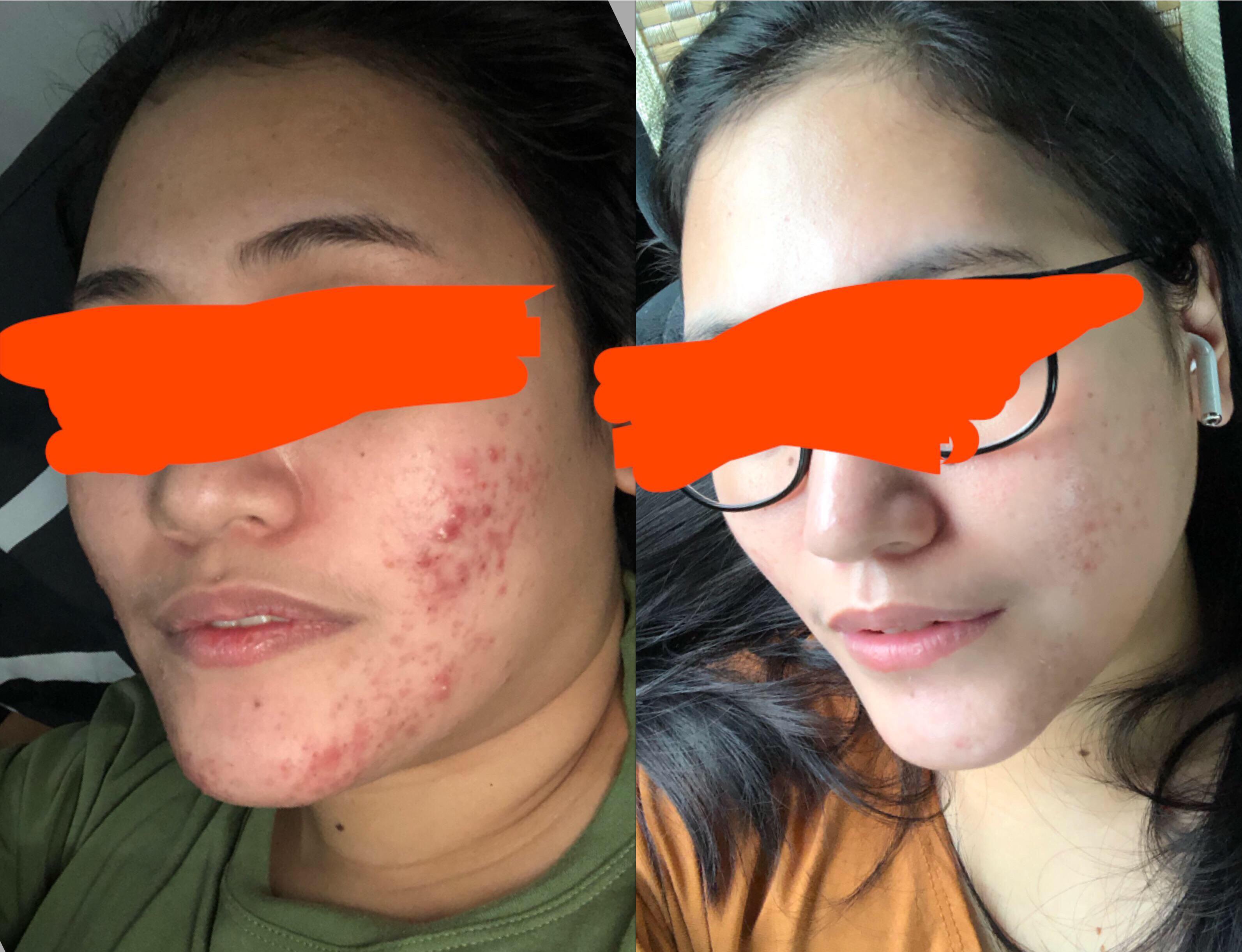 I STOPPED Washing my FACE in the MORNING! I know this sounds crazy and