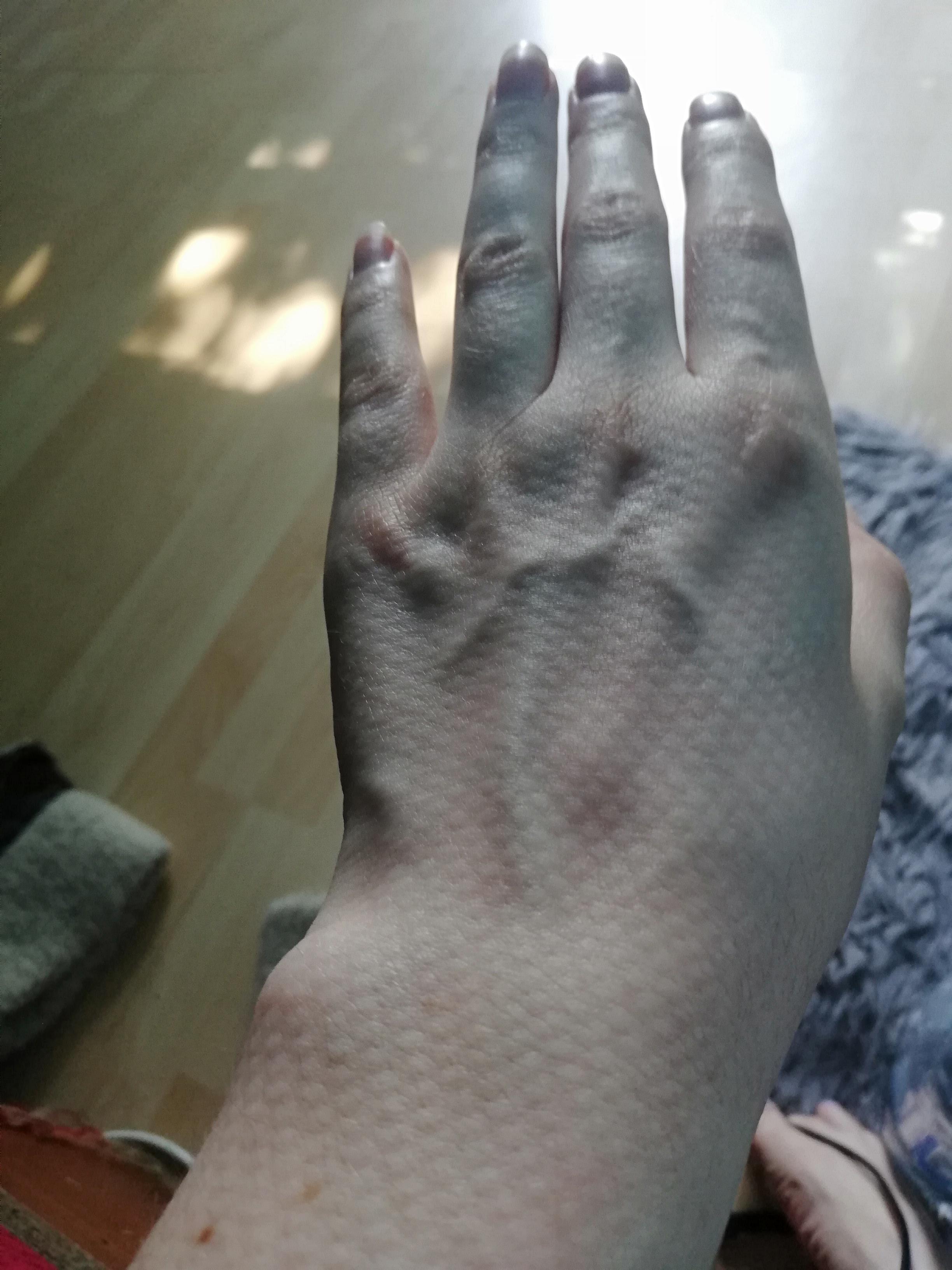 My skin looks like it's got scales after i slept on it. r