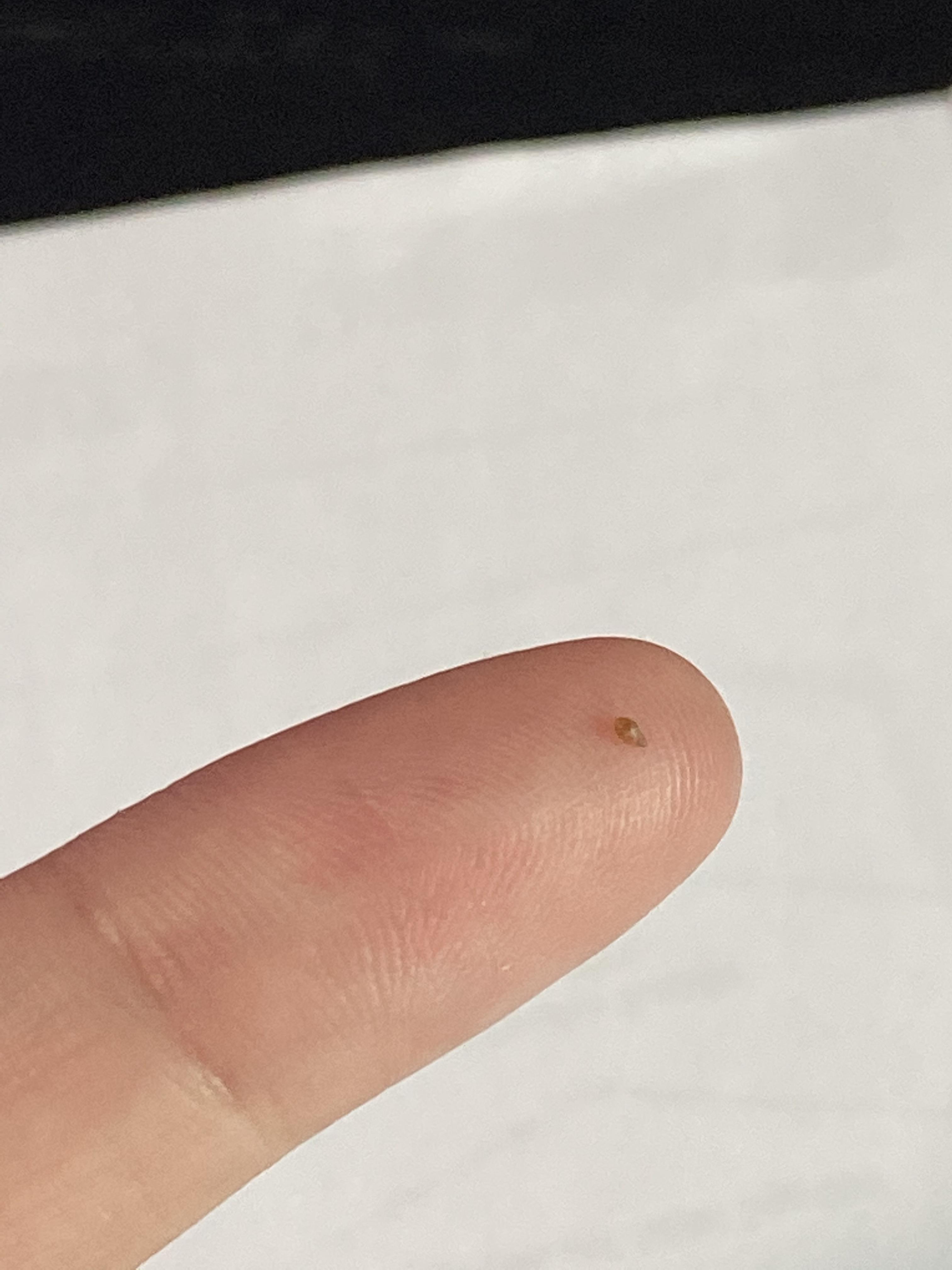 Popped a blackhead on my leg! Here’s the tiny aftermath r/popping