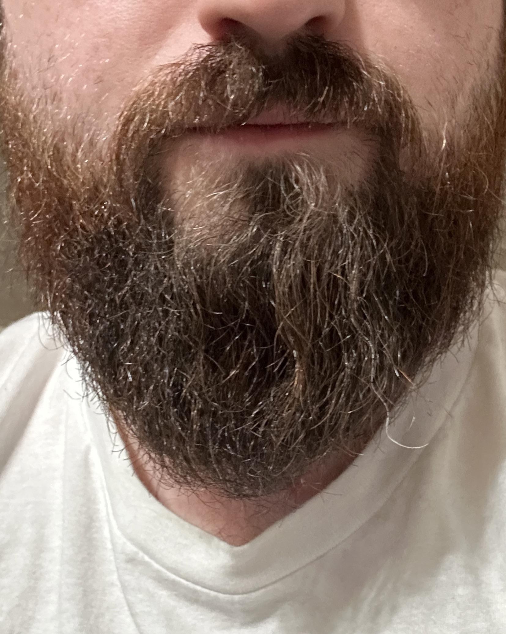 I have one snow white beard hair that grows at 10x the rate of the rest