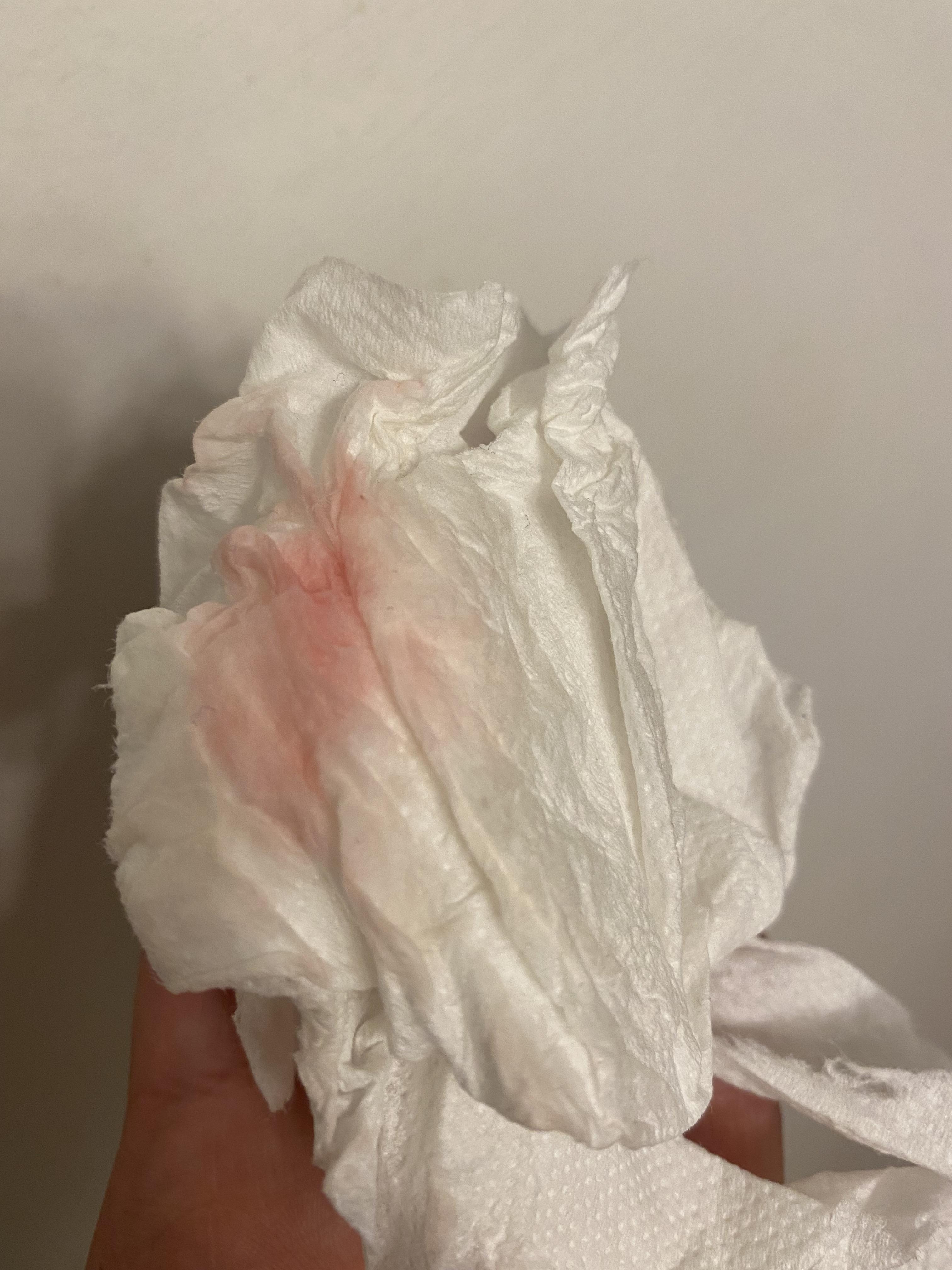 24f light pink discharge for 3 days. Right side of abdomen hurting a