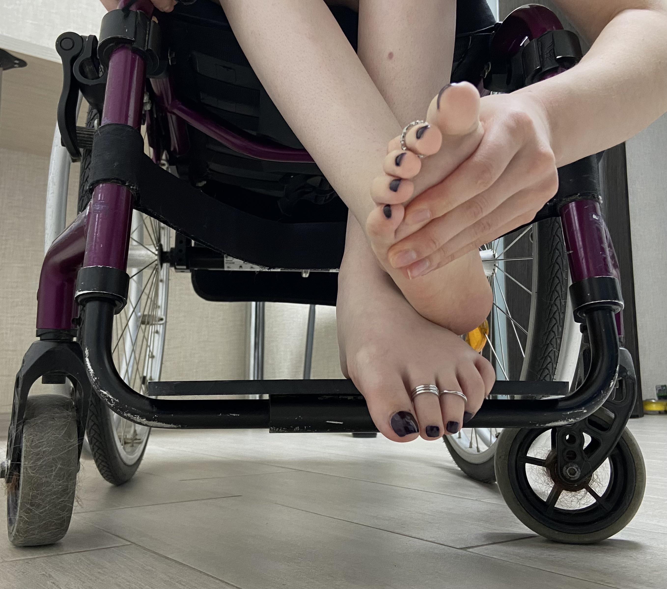 my paraplegic legs r/VerifiedFeet