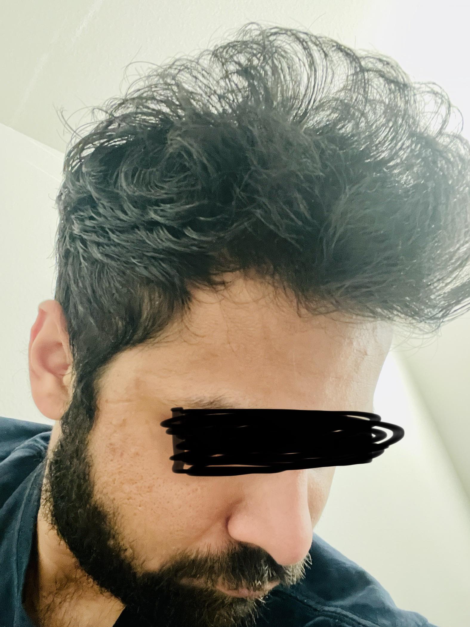 How do I control the frizz? r/malehairadvice