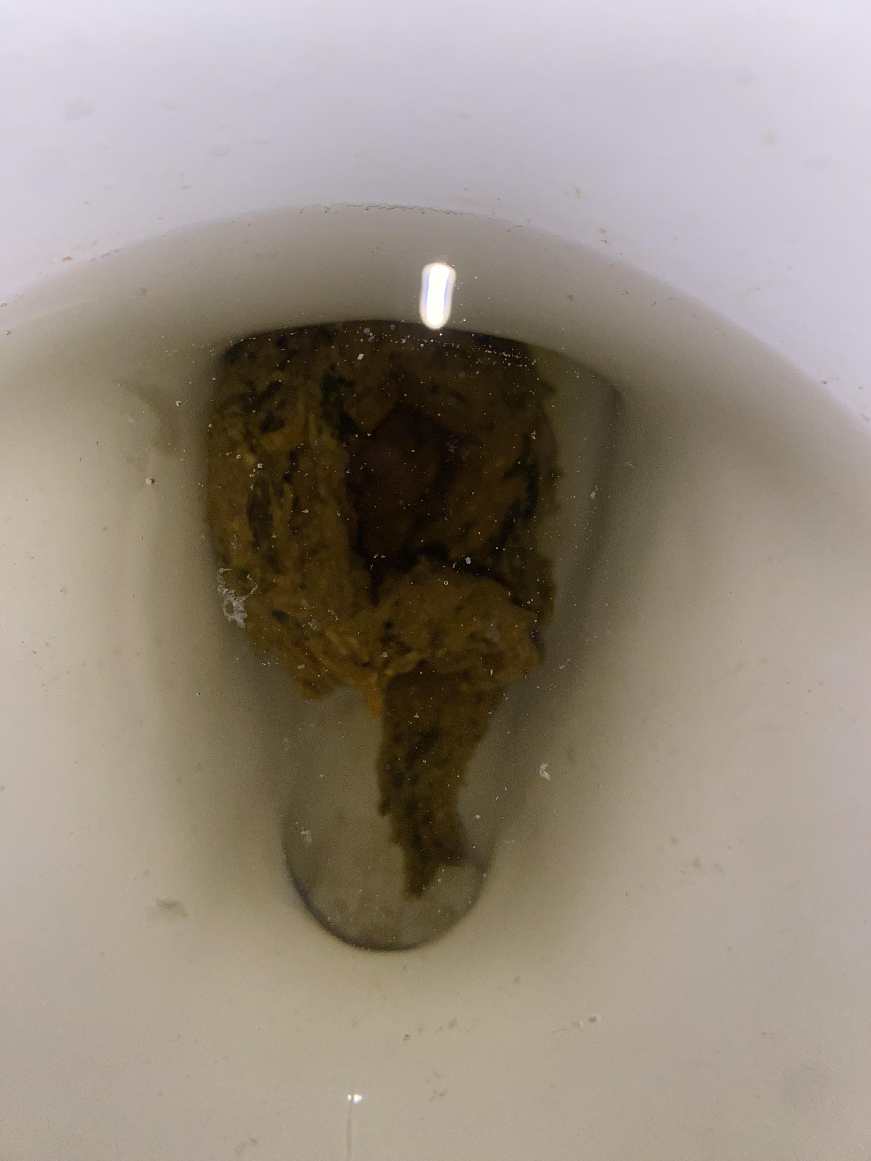 Is this a cause for concern? Black streaks r/poop