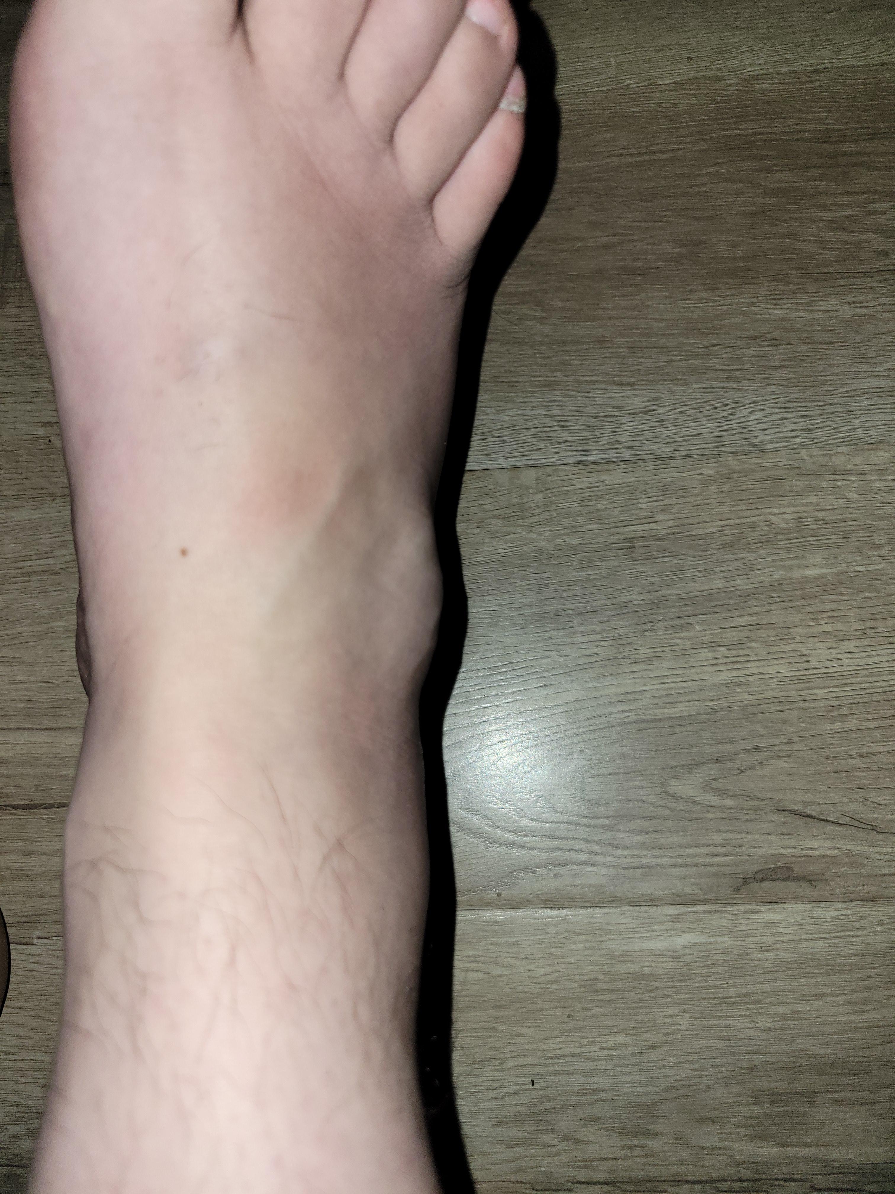 what is this lump near my ankle? I have the same on the other foot