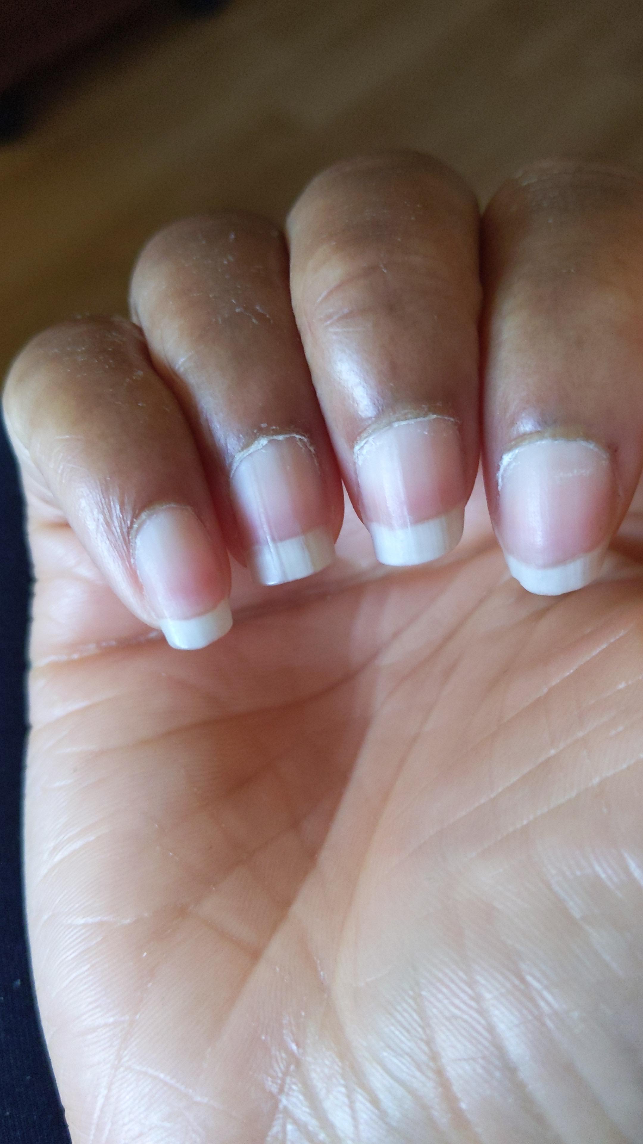 Weird lines going through the nail on the ring finger on my right hand