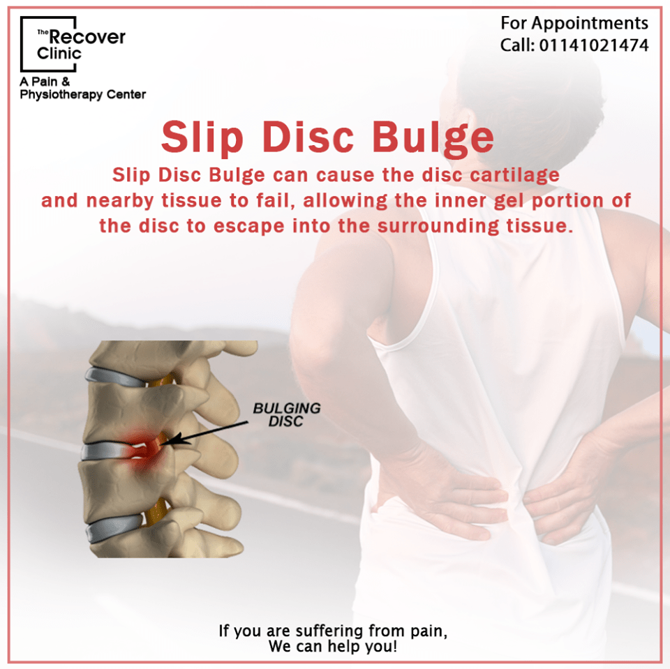 Slip Disc Treatment in r/Infographics