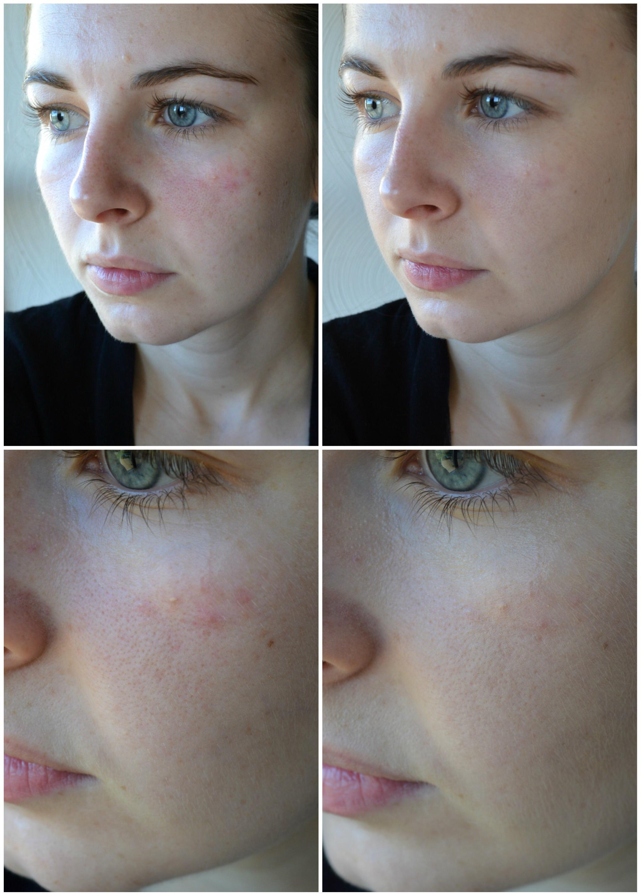 Before & After blown away by the Klairs BB Cream r/MakeupAddiction