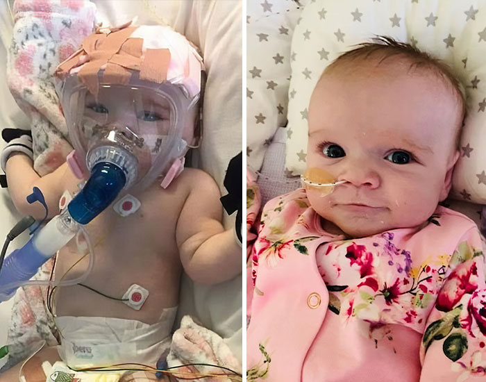 After having heart surgery this baby gets covid19 and survives. How beautiful life is
