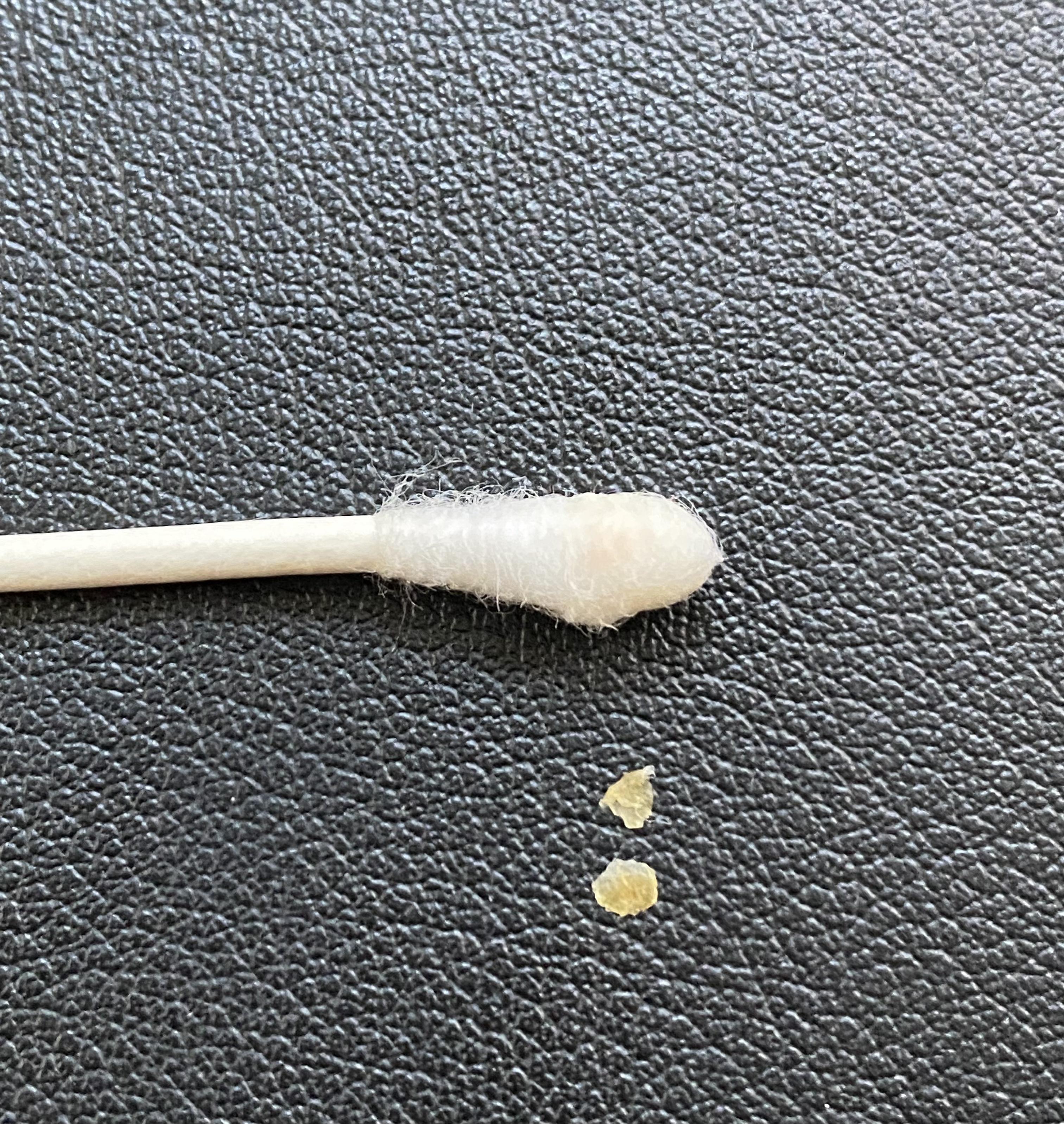 Just A Few Dry Flakes From My Right Ear r/earwax