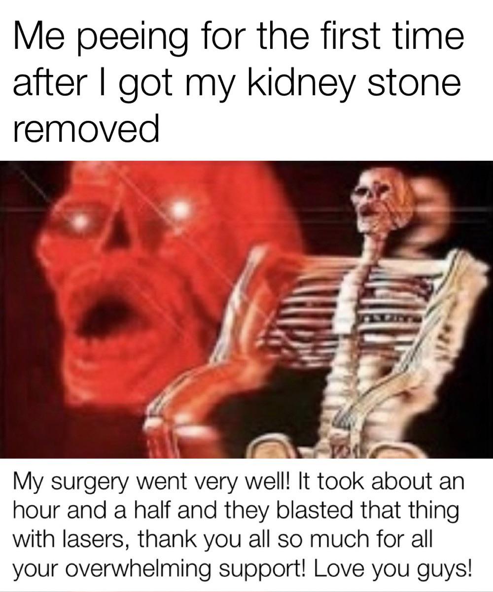 So I’m having a kidney stone removed today… PART 2 Funny Pictures