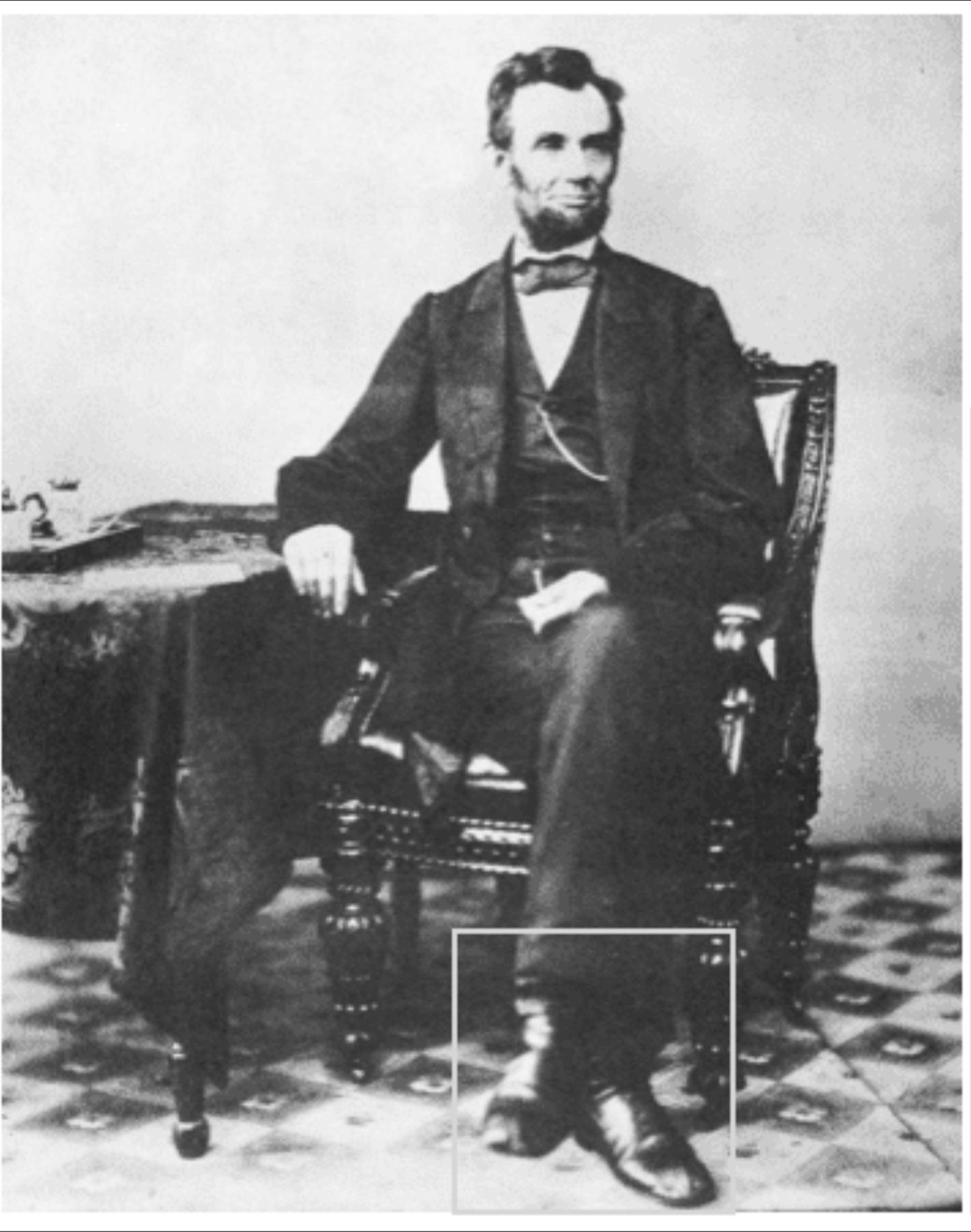 Abraham Lincoln was suspected to have Marfan's syndrome (described in