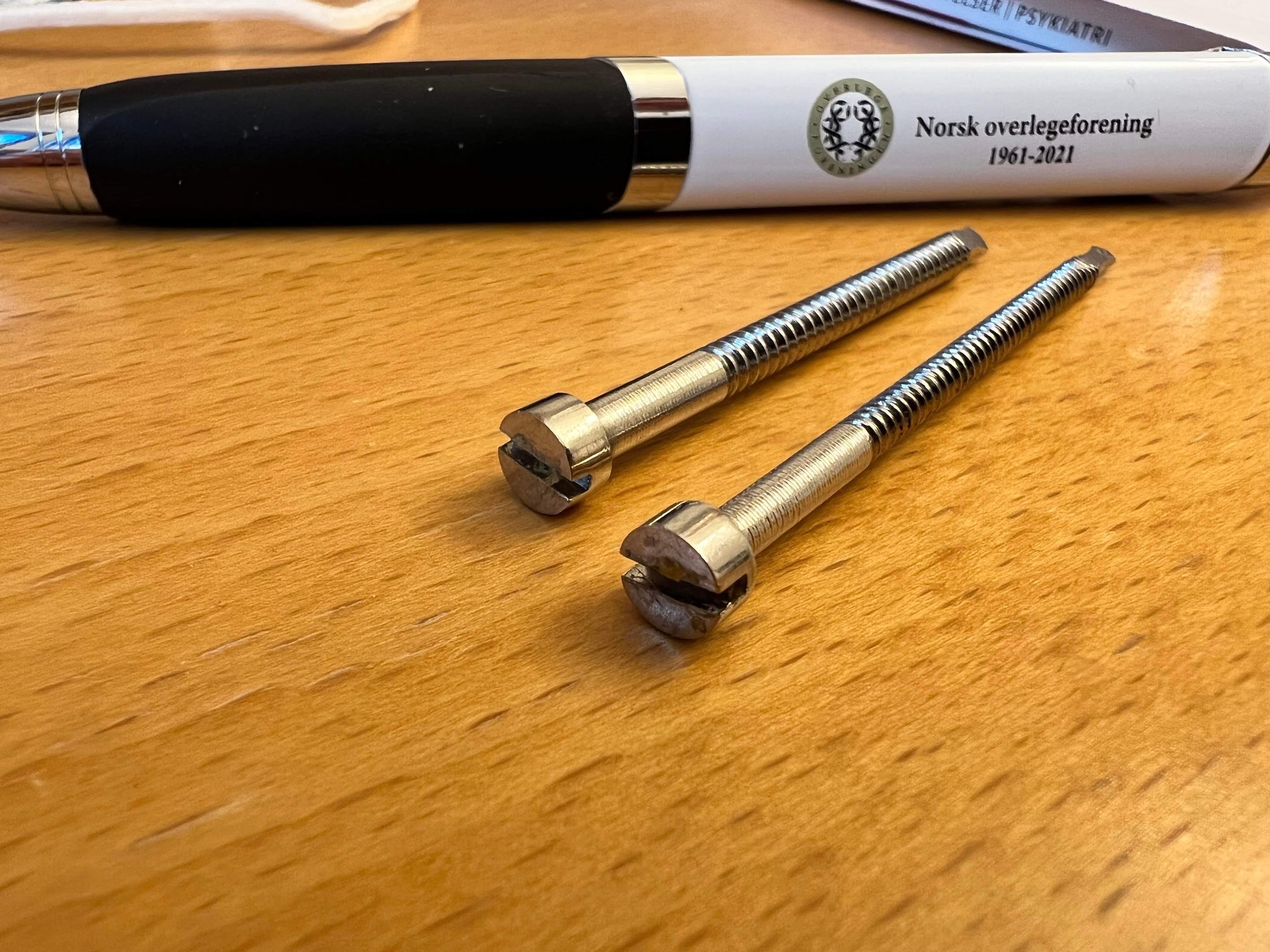 Screws taken out of toe after surgery in dodgy clinic, but they do not